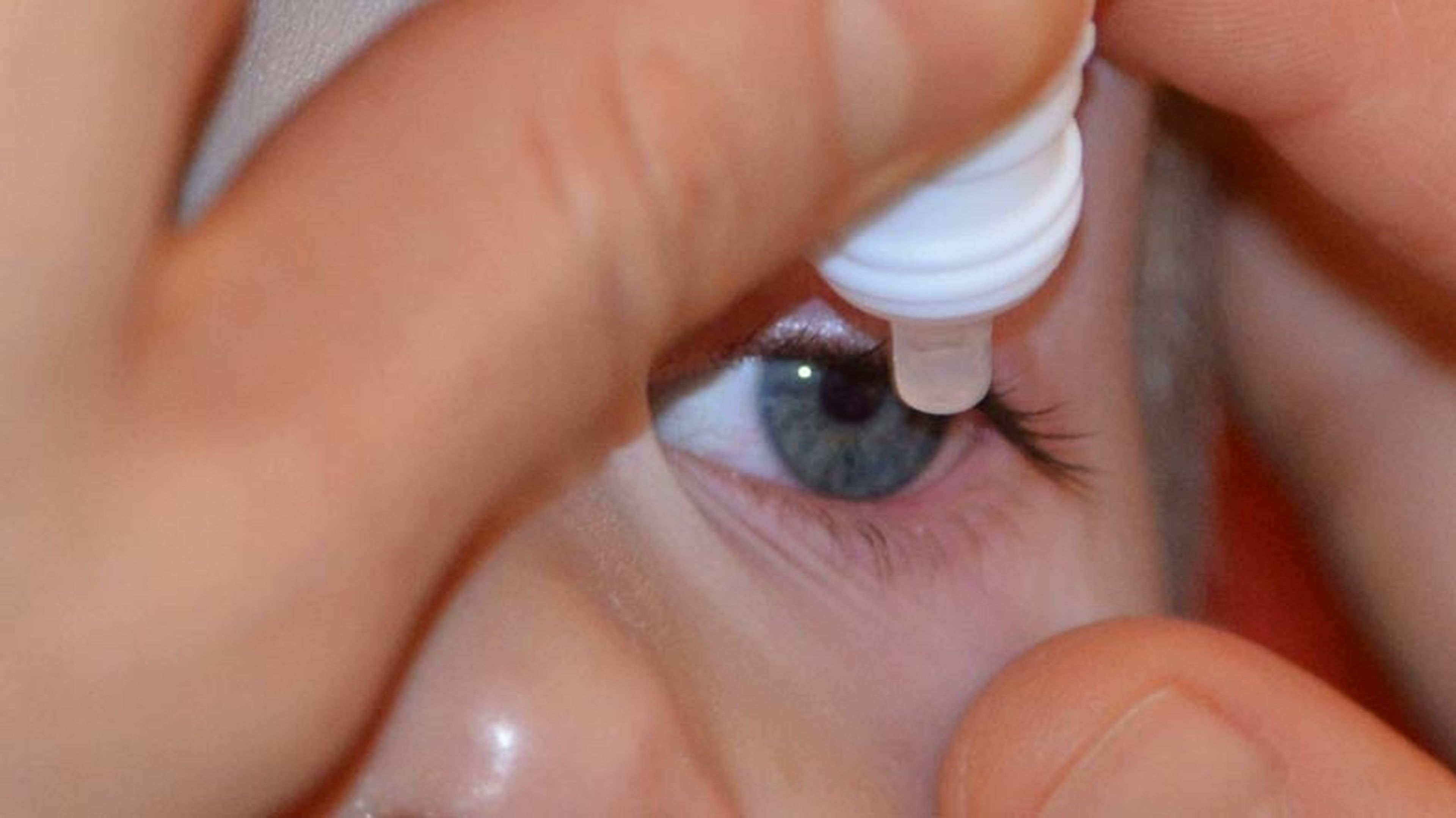 Gotas en los ojos para curar la miopía