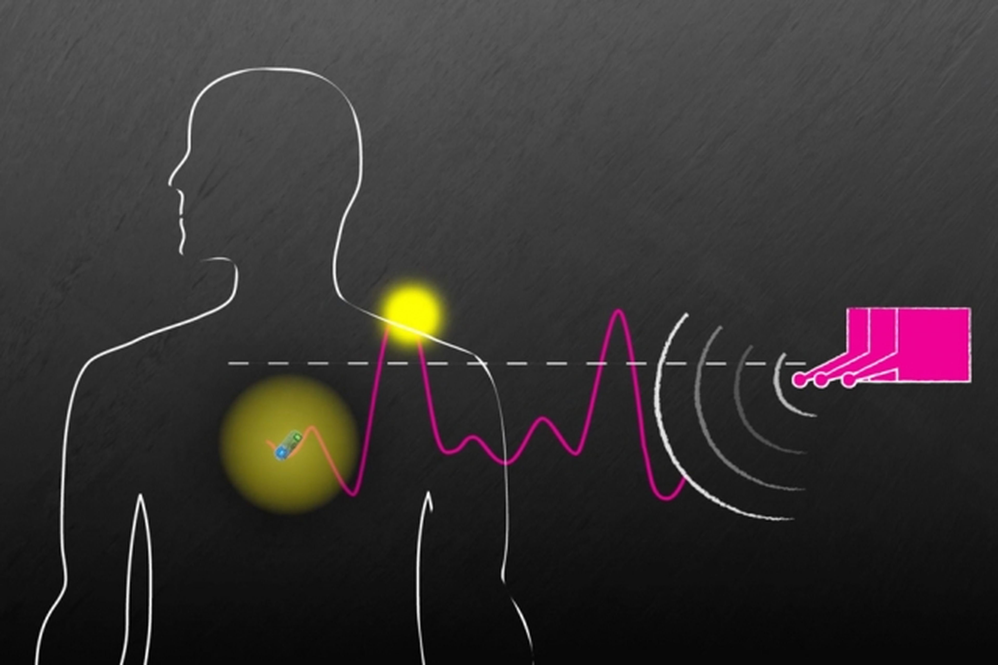 Ilustración del MIT sobre el nuevo sistema de ondas para controlar implantes.