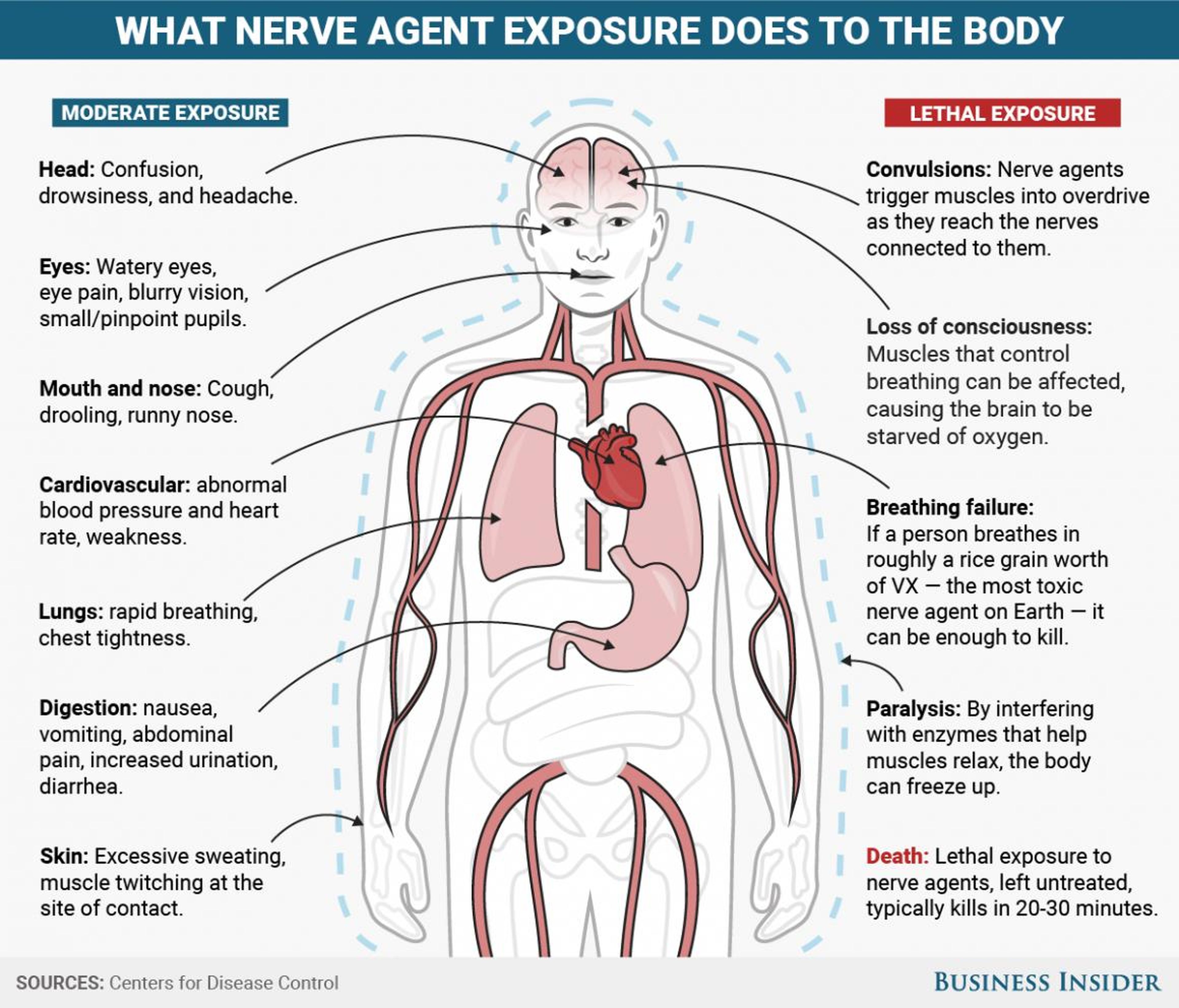 Los agentes nerviosos como el tabún, sarín, somán, GF y VX tienen efectos similares en el cuerpo, dependiendo de la ruta de exposición.