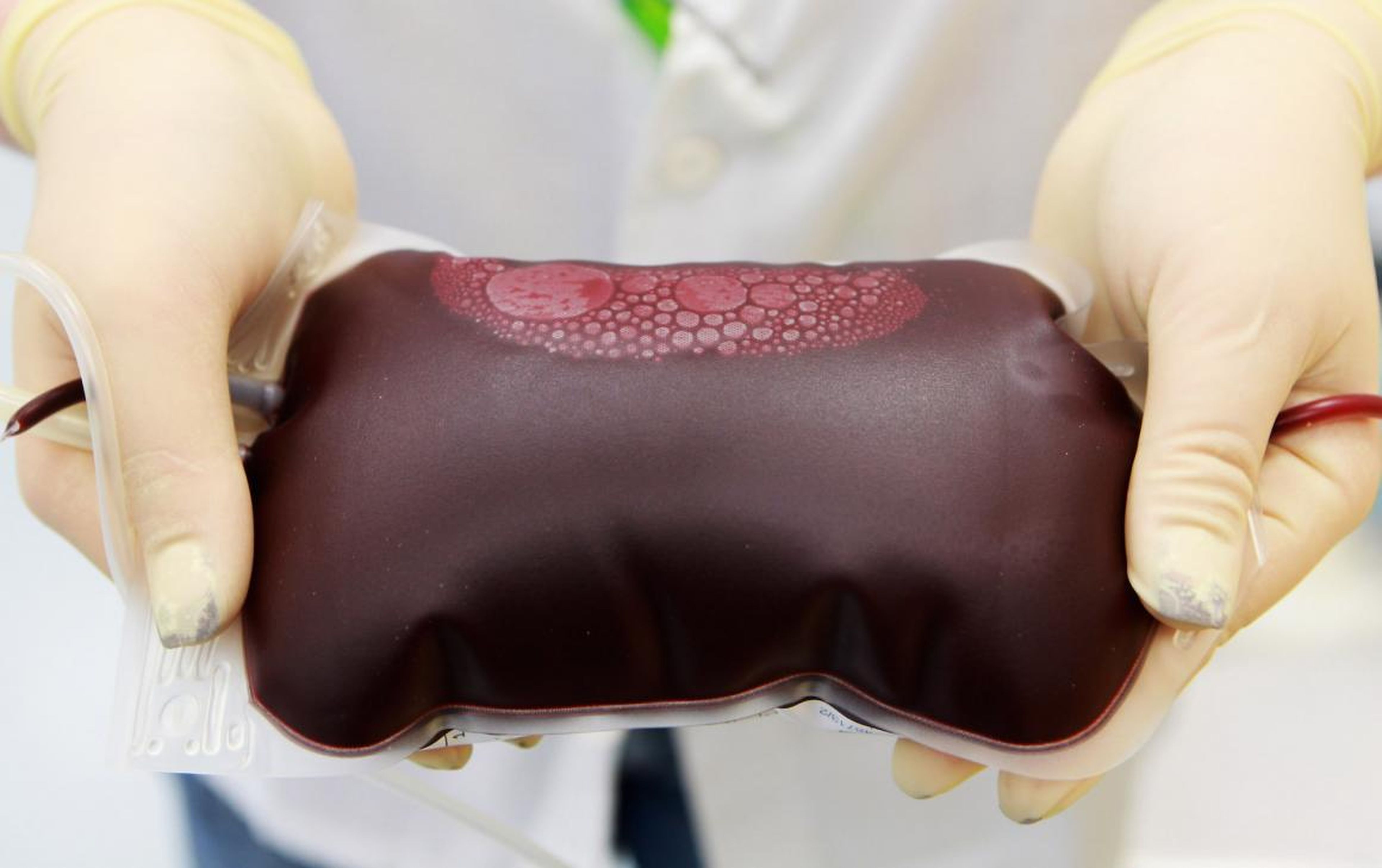 A controversial startup called Ambrosia had offered to fill your veins with the blood of young people for $8,000. It said on Tuesday that it had stopped providing the procedure.