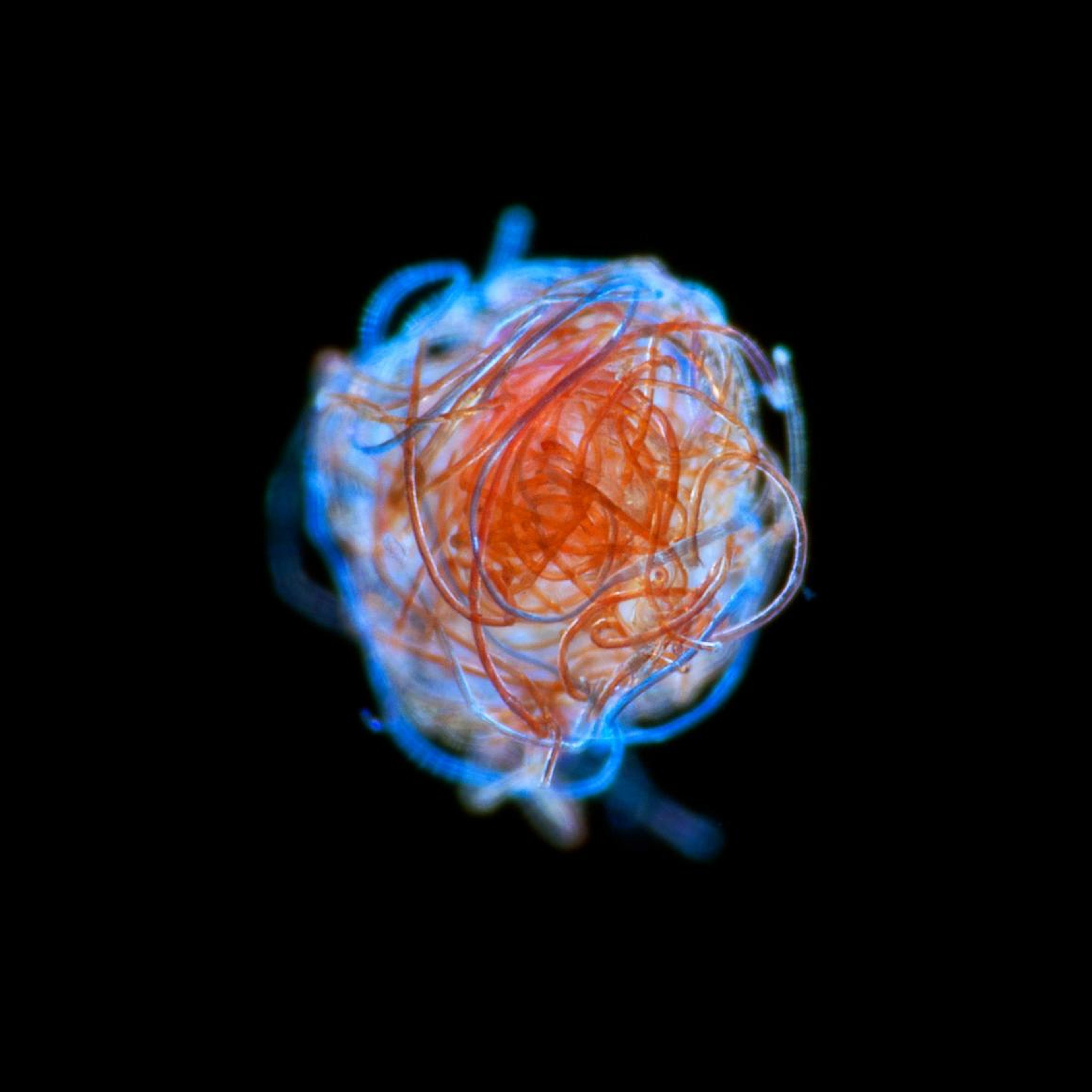 A ball of plastic microfibers found drifting in the ocean's plankton.