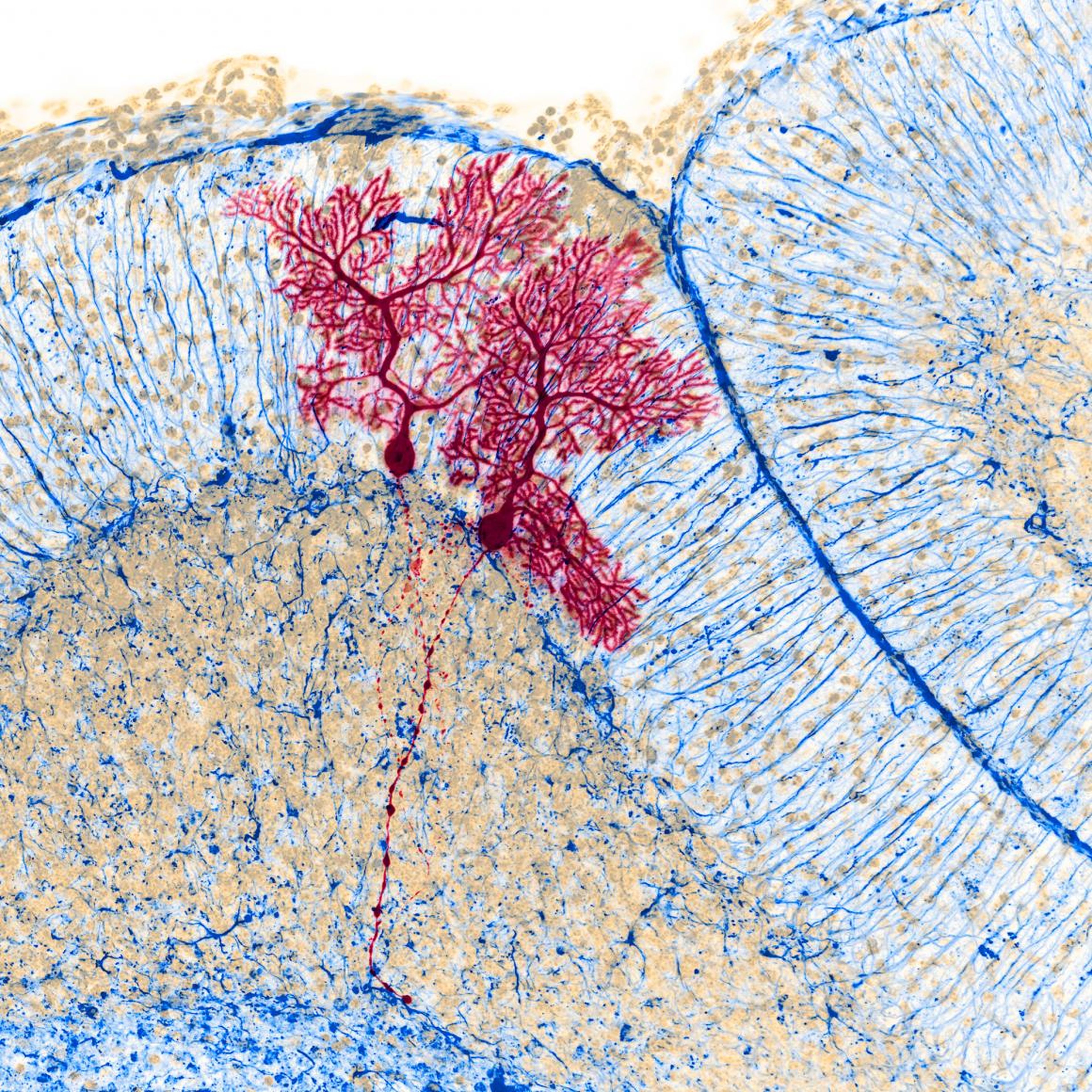 Dye-injected nerve cells inside a mouse's brain.