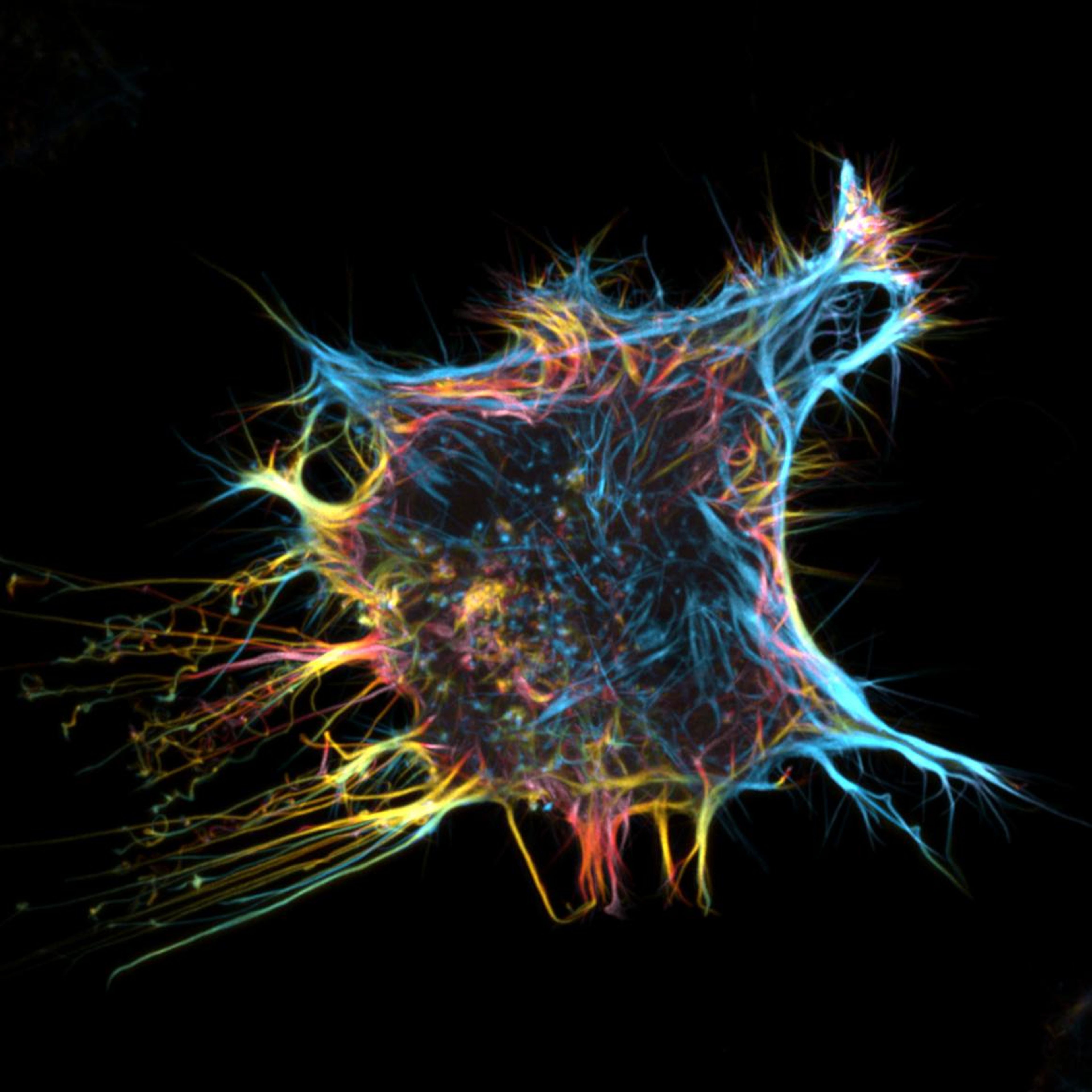 Fluorescent protein in a living HeLa cell, which is the oldest human cell line used in scientific research.