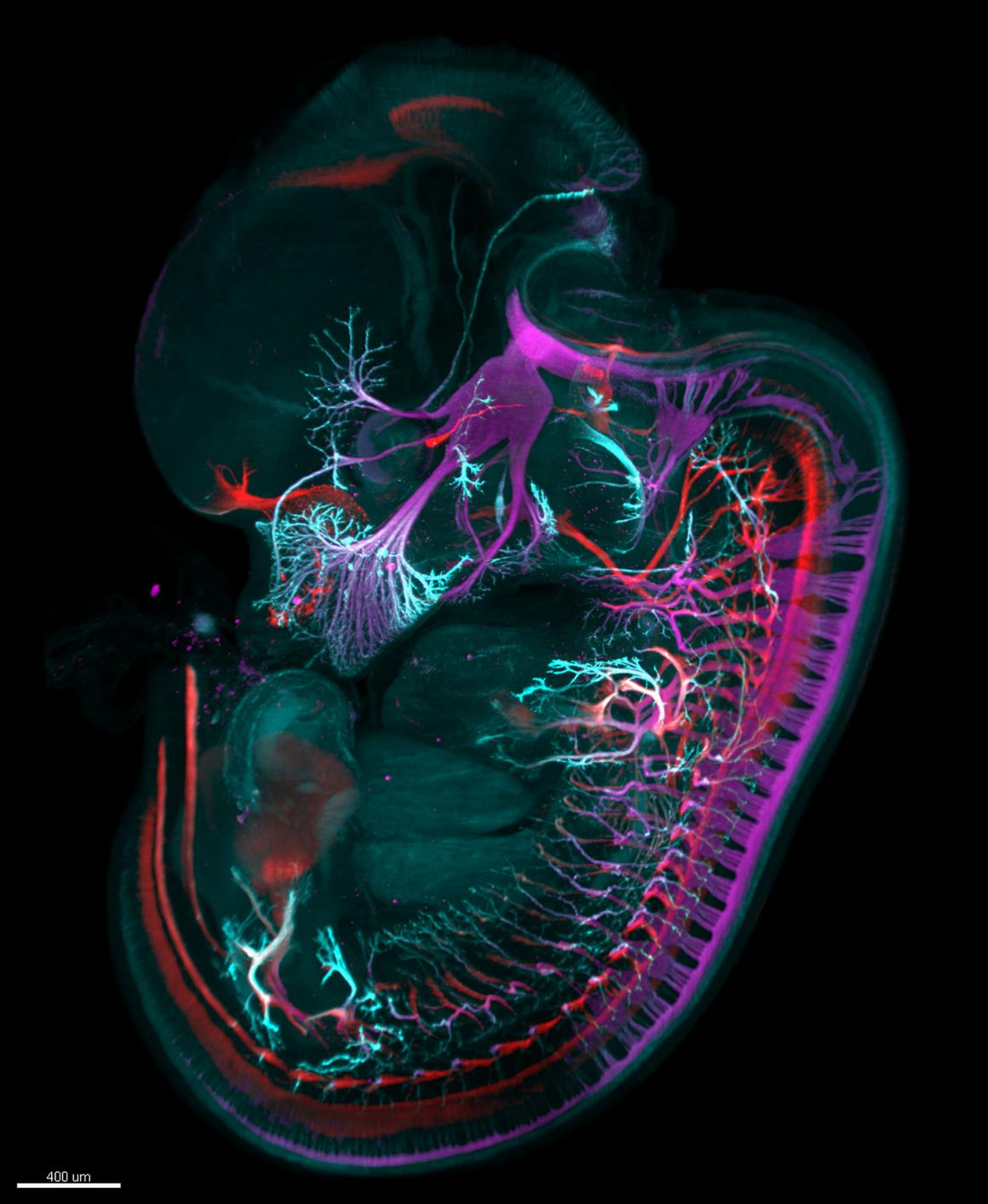 Mouse embryo (day 12.5) stained for motor (red) and sensory (magenta) nerves and nerve endings (cyan)