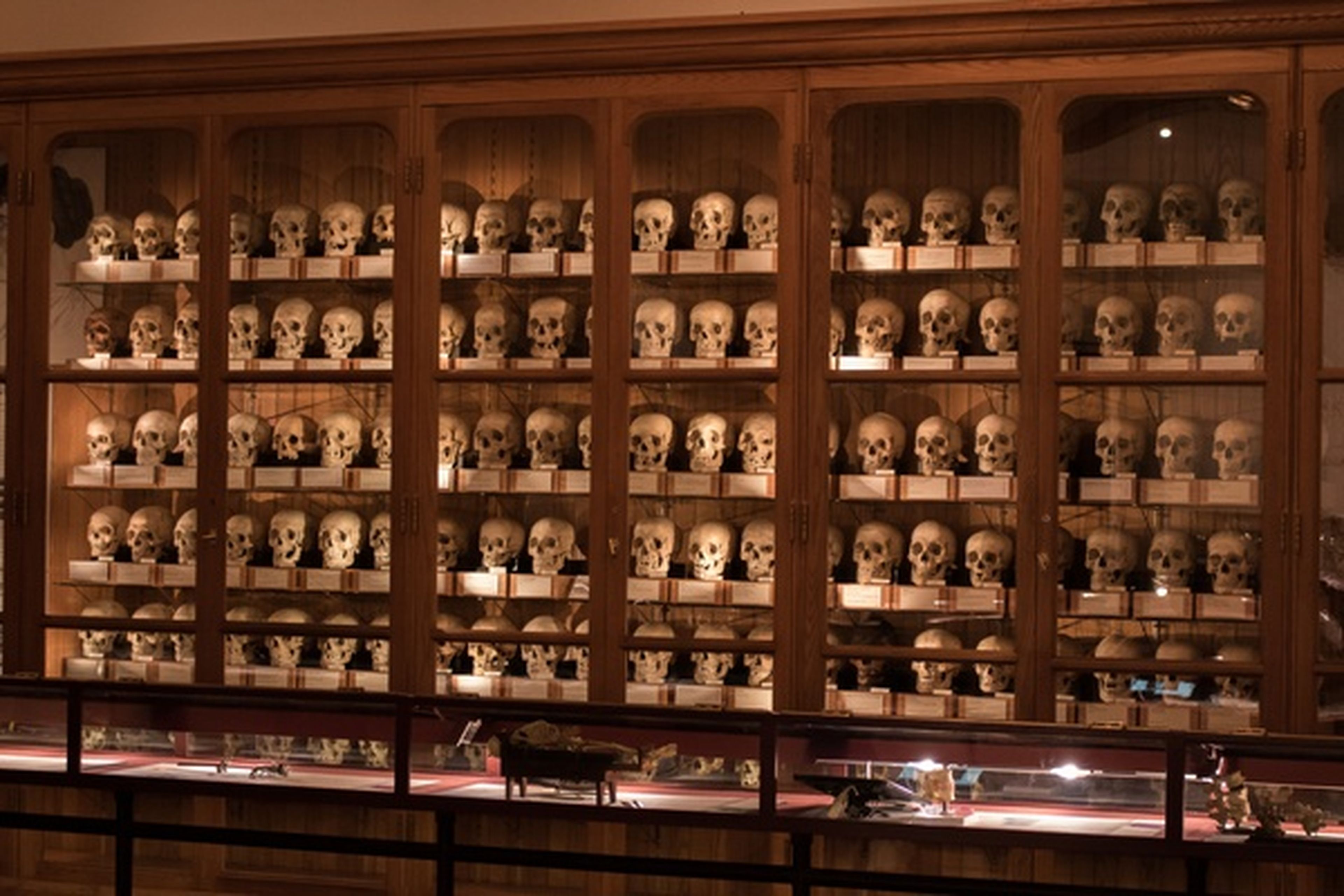 Museo de la medicina de Mutter. Calavera, terror
