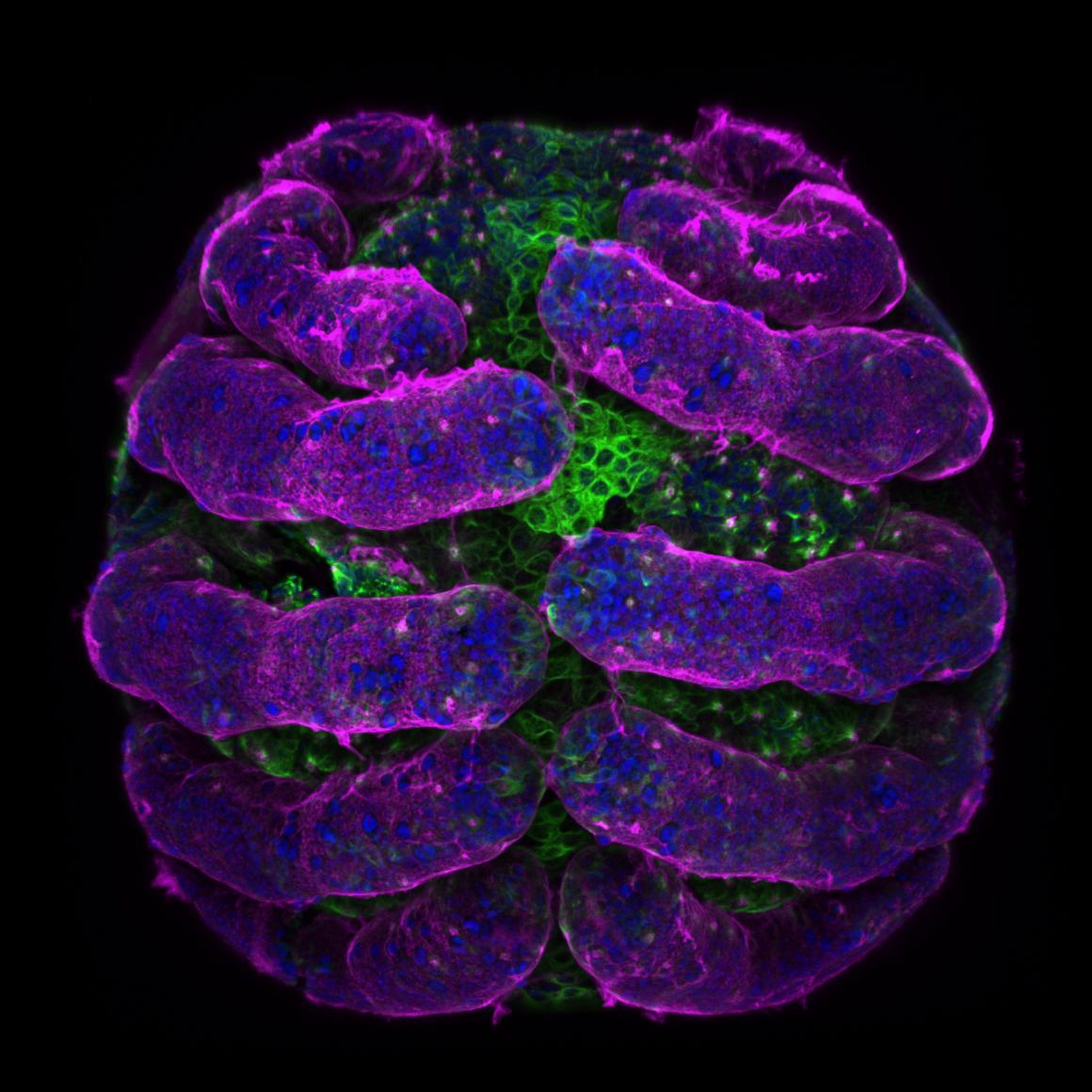 No. 5: A spider embryo with its surface in pink and microtubules in green.