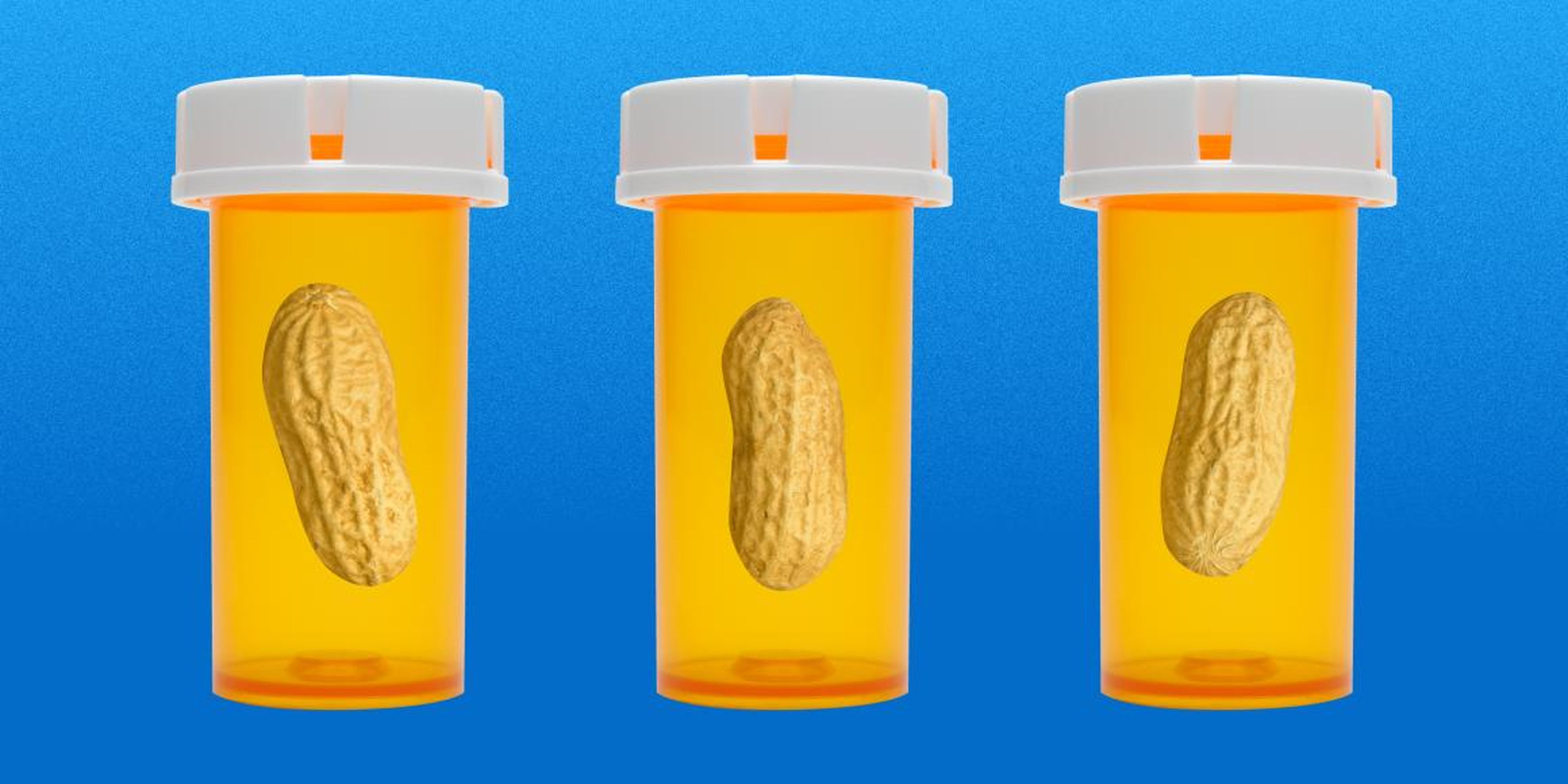 La nueva terapia pretende erradicar el efecto de aquellas ingestas accidentales de cacahuetes para alérgicos.