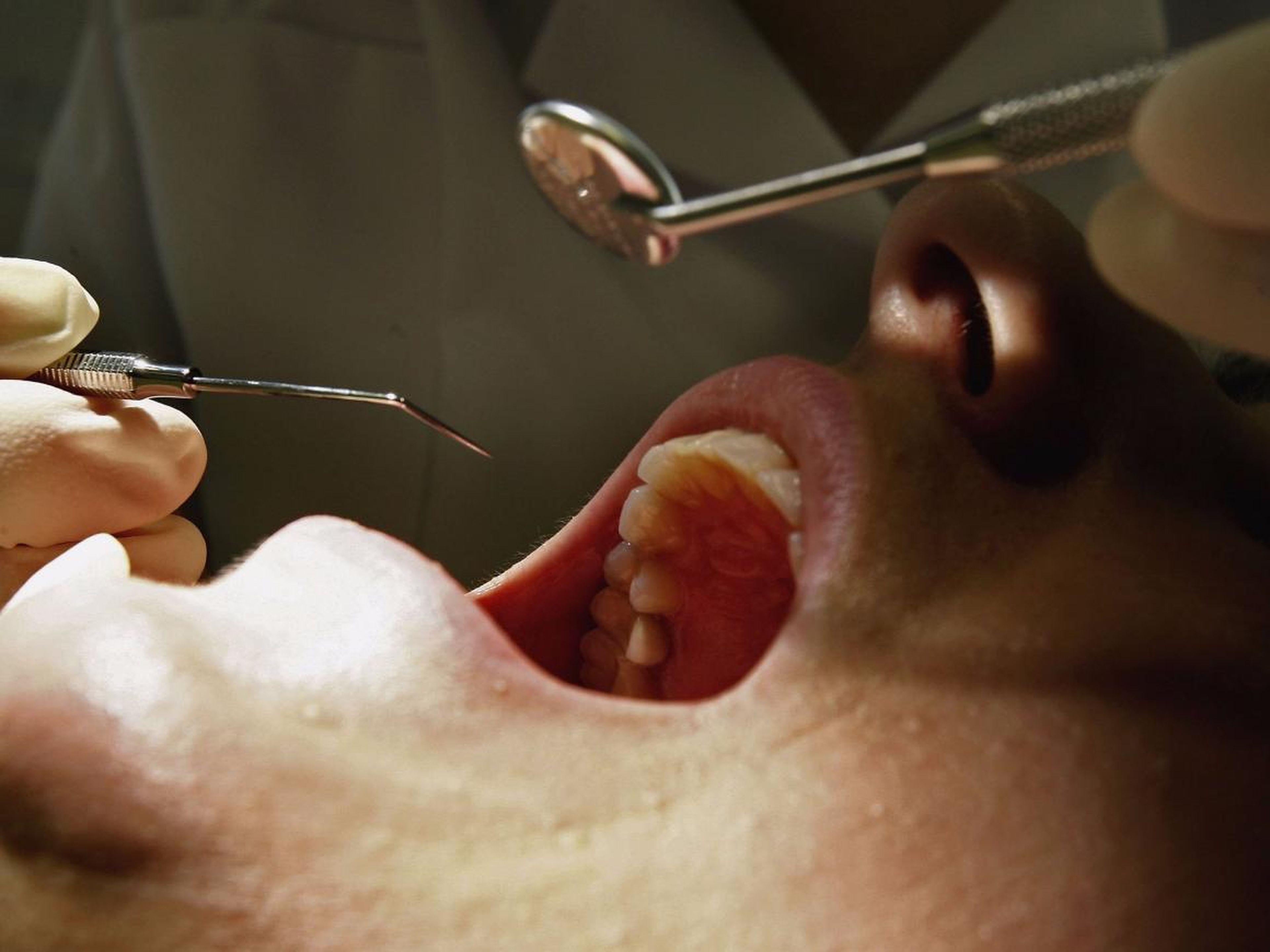 Podrías estar dañando tus dientes todos los días
