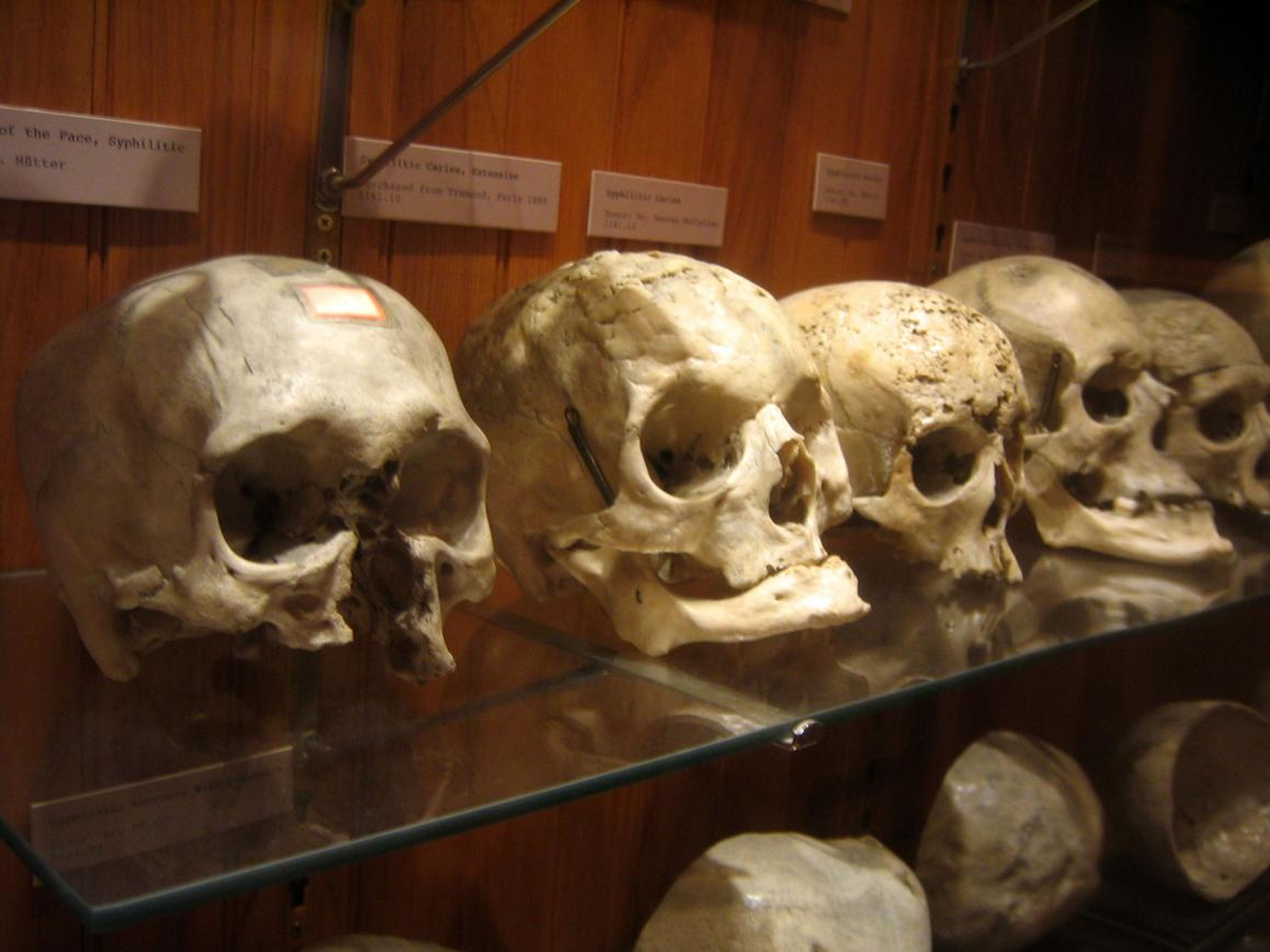 Hay cráneos humanos expuestos.