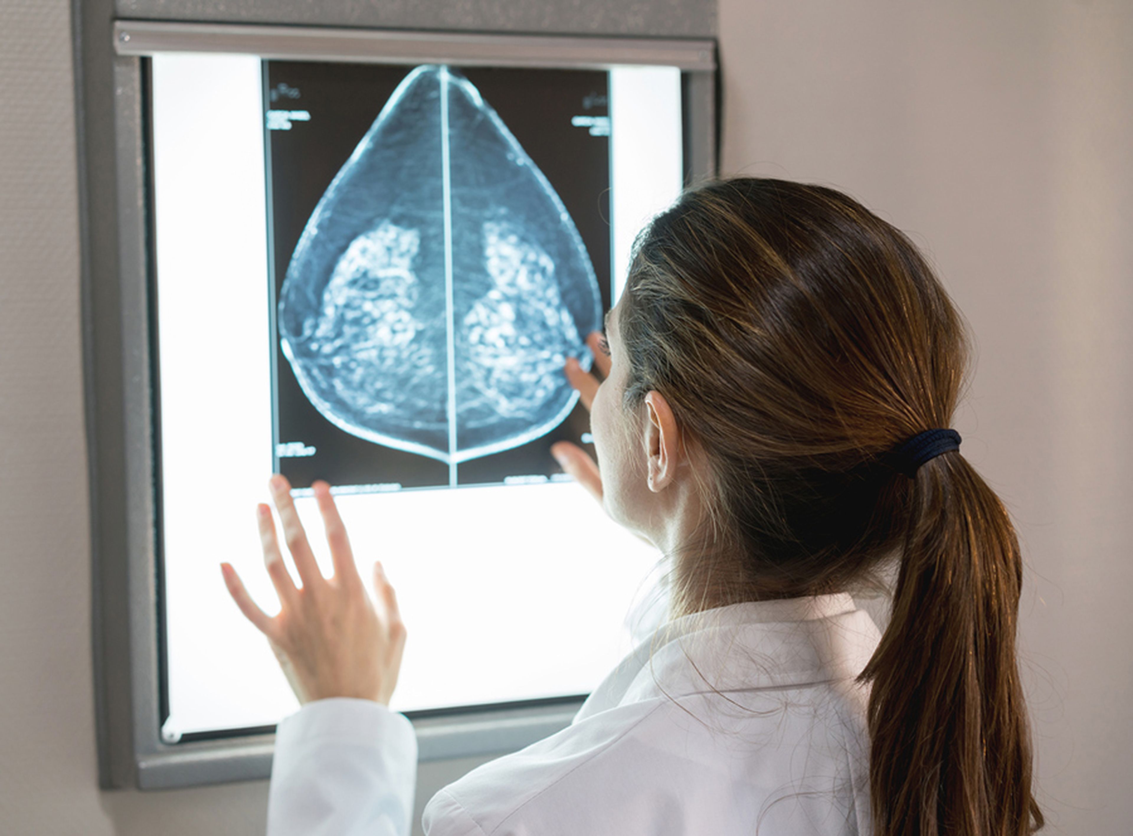 Una doctora revisa una mamografía