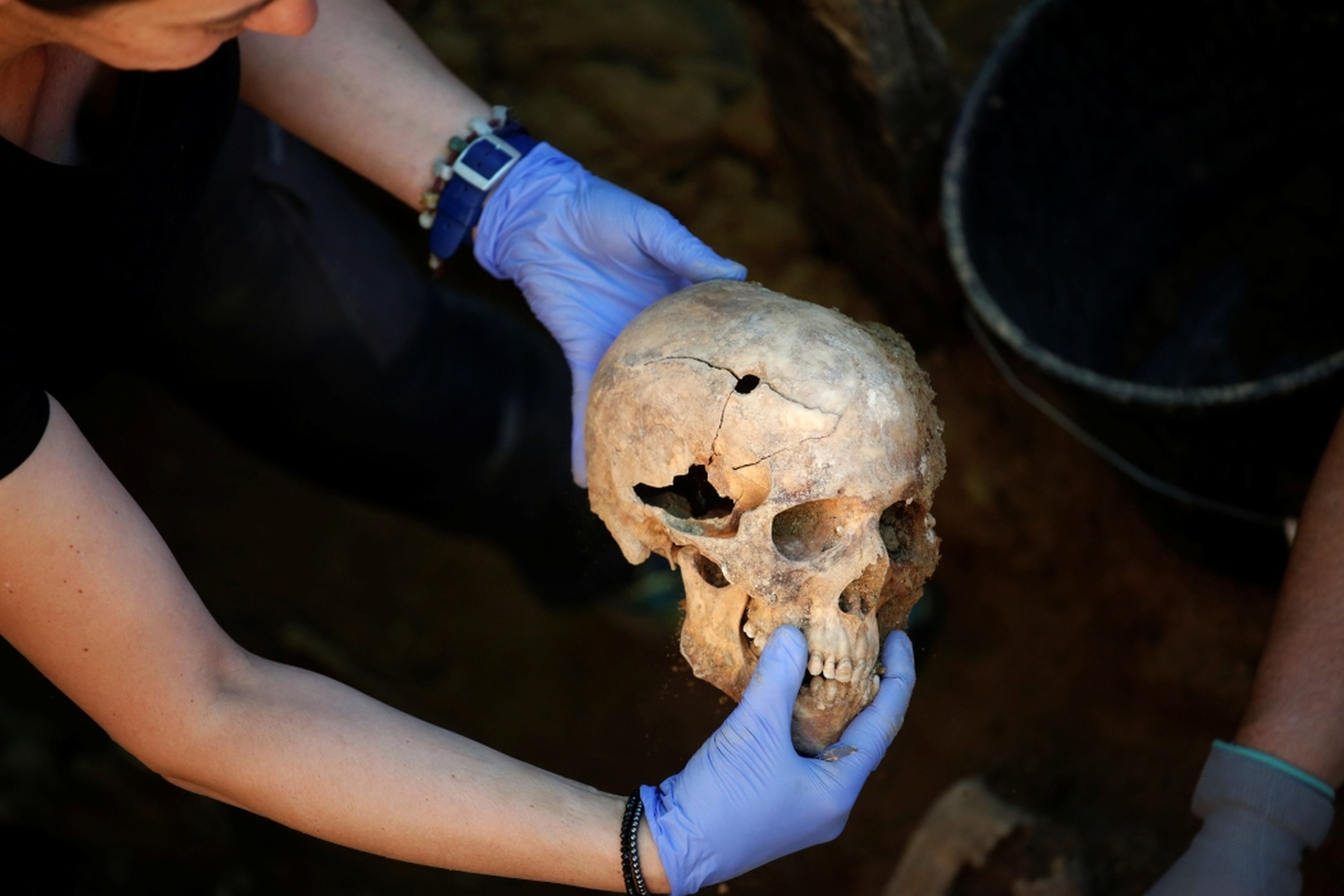 Una calavera humana con el agujero de una bala encontrada durante una exhumación en el cementerio de Guadalajara, en mayo de 2017, cuando se identificaron los restos de Timoteo Mendieta, fusilado en 1939.
