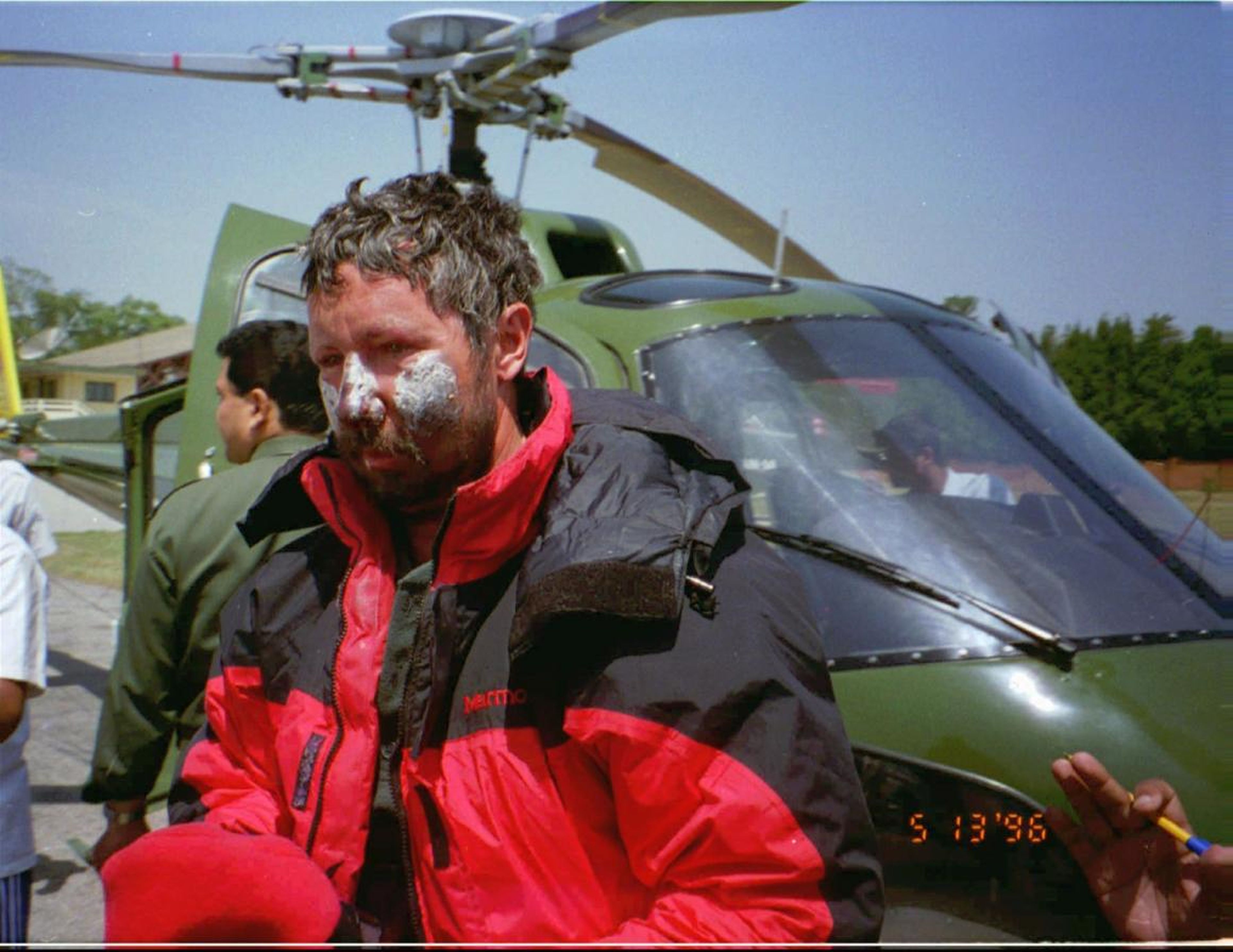 Beck Weathers de Dallas, Texas, con el rostro congelado tras una expedición sueca en 1996 antes de ser rescatado por un helicóptero