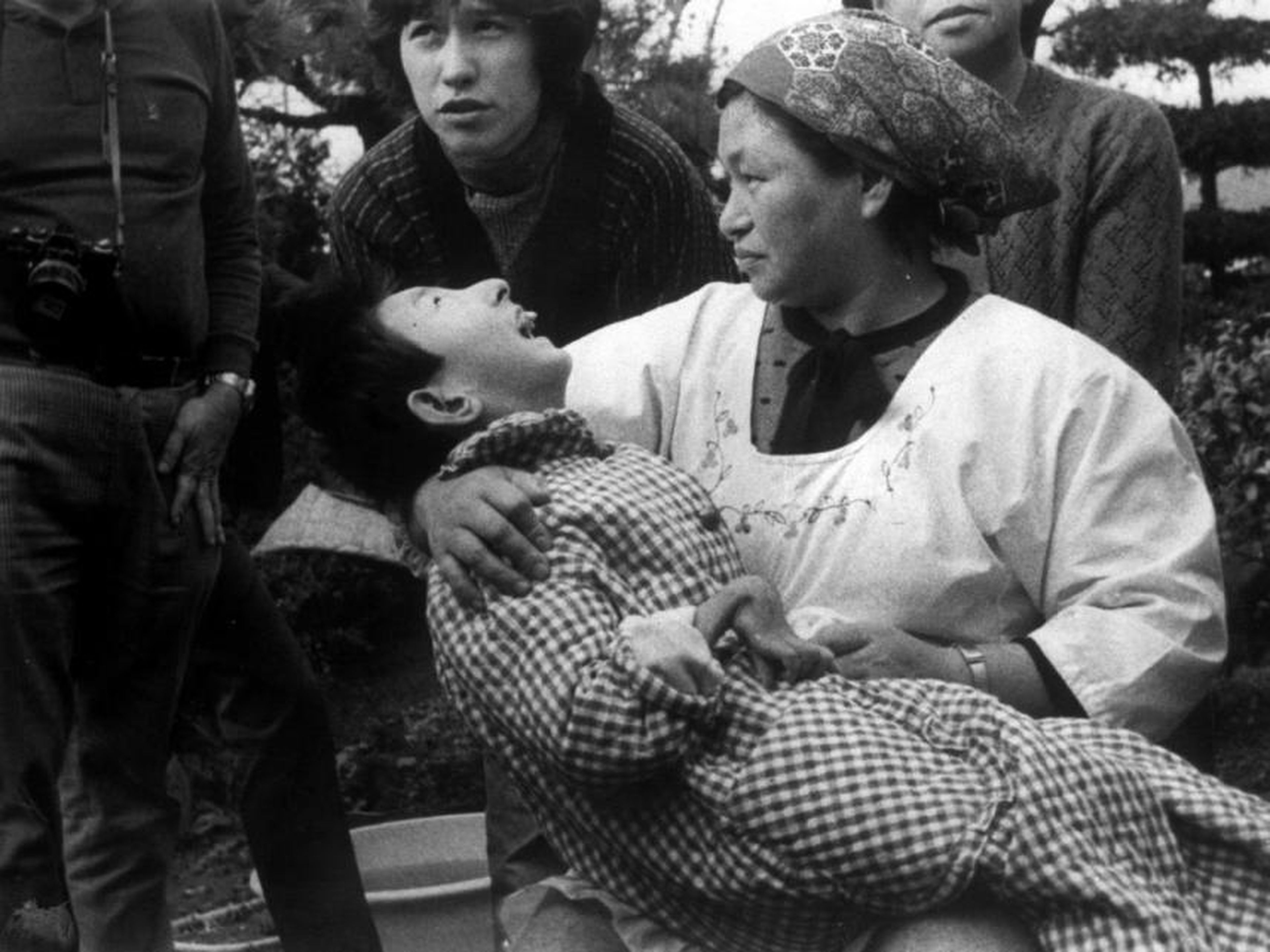 Una mujer sostiene a una víctima de la "enfermedad de Minamata", o envenenamiento por mercurio, en Minamata, Japón, en 1973. La niña tiene una mano malformada, como muchas víctimas de la enfermedad.