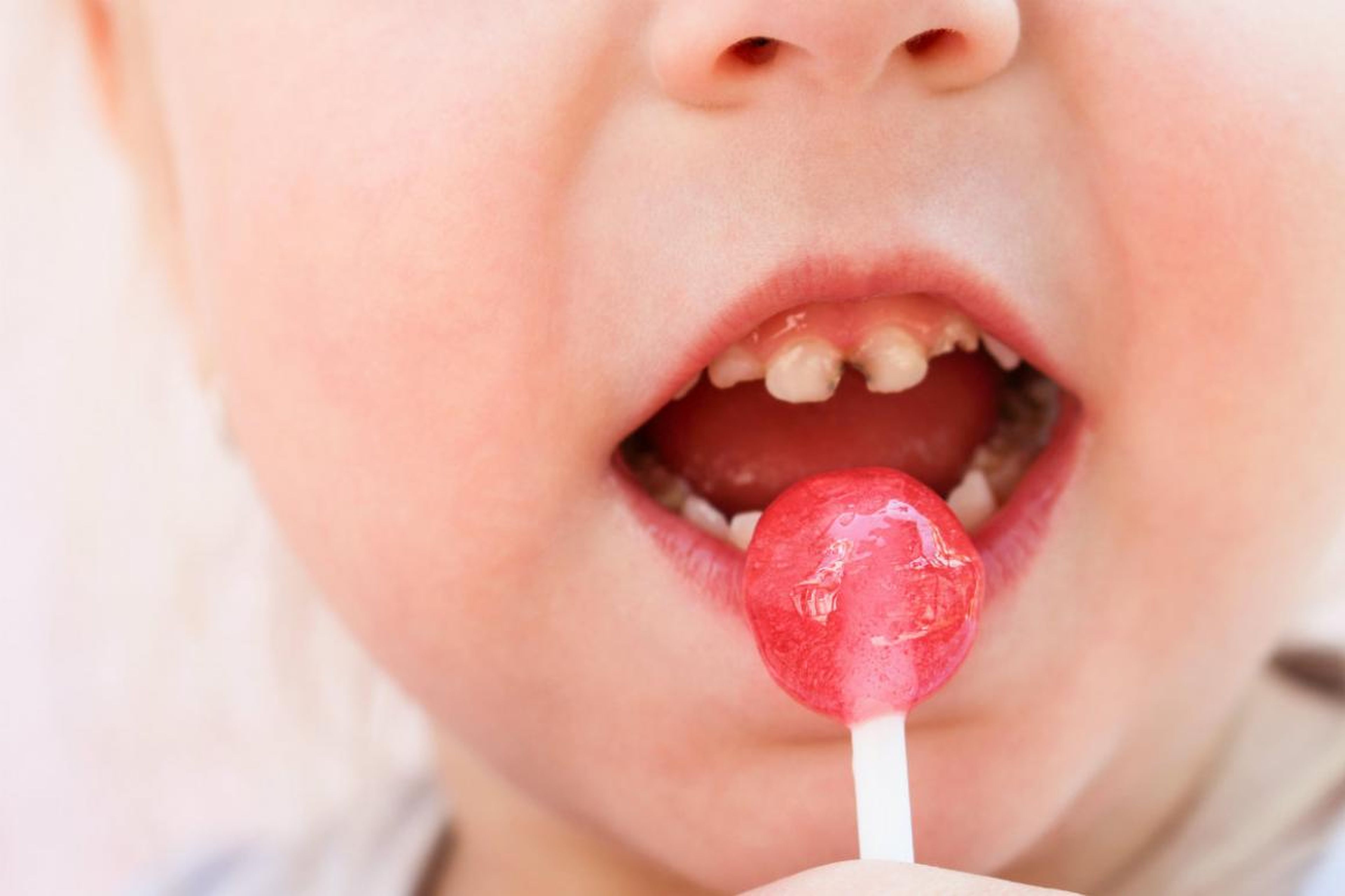 "El azúcar interactúa con las bacterias y produce ácidos que se disuelven y dañan el esmalte dental, provocando que el diente se pudra", advirte Rebecca Lee.