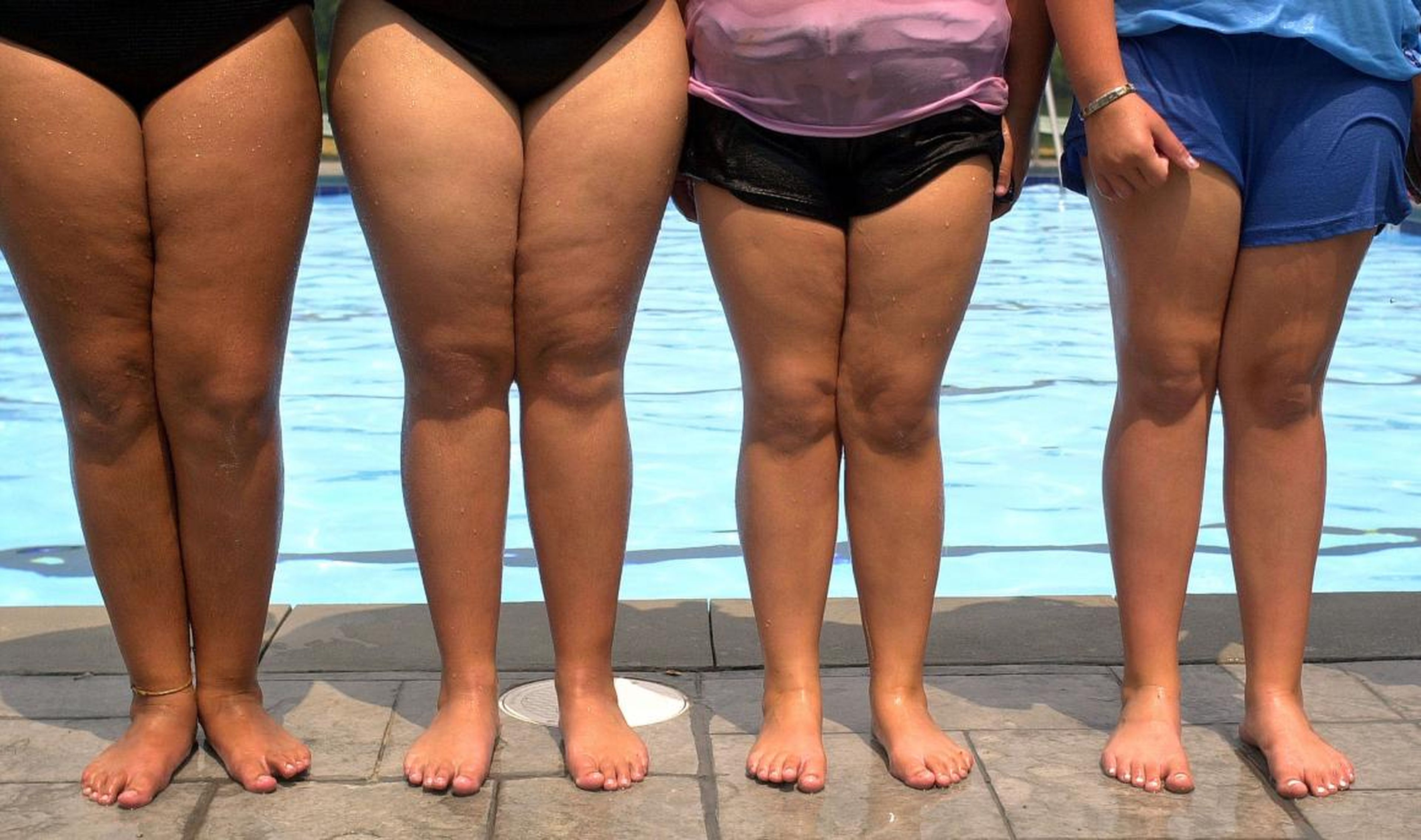 But some obesity-related cancer rates are soaring in young people, and doctors are worried it's a troubling sign of what's to come.
