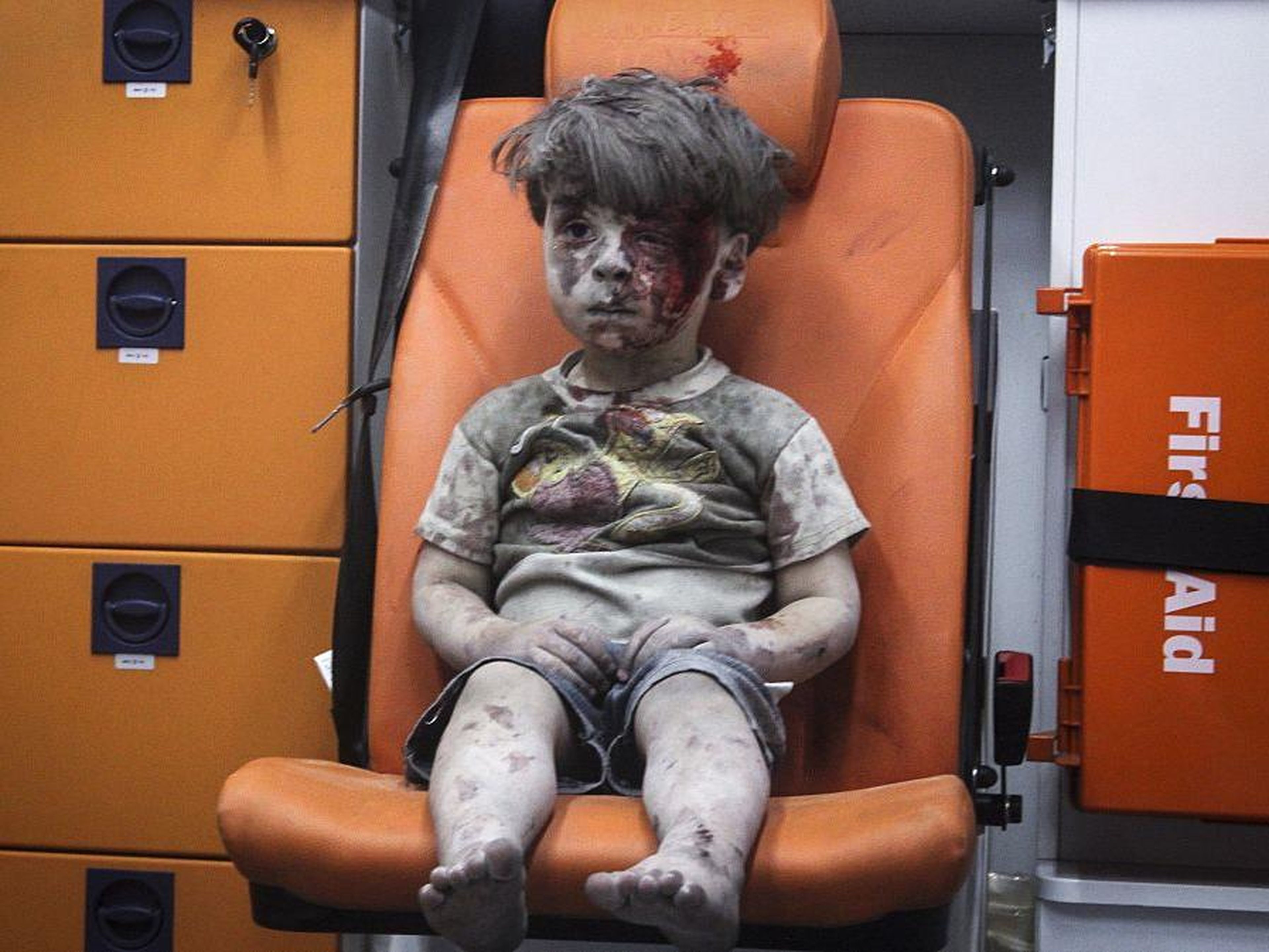 El niño sirio de 5 años Omran Daqneesh.