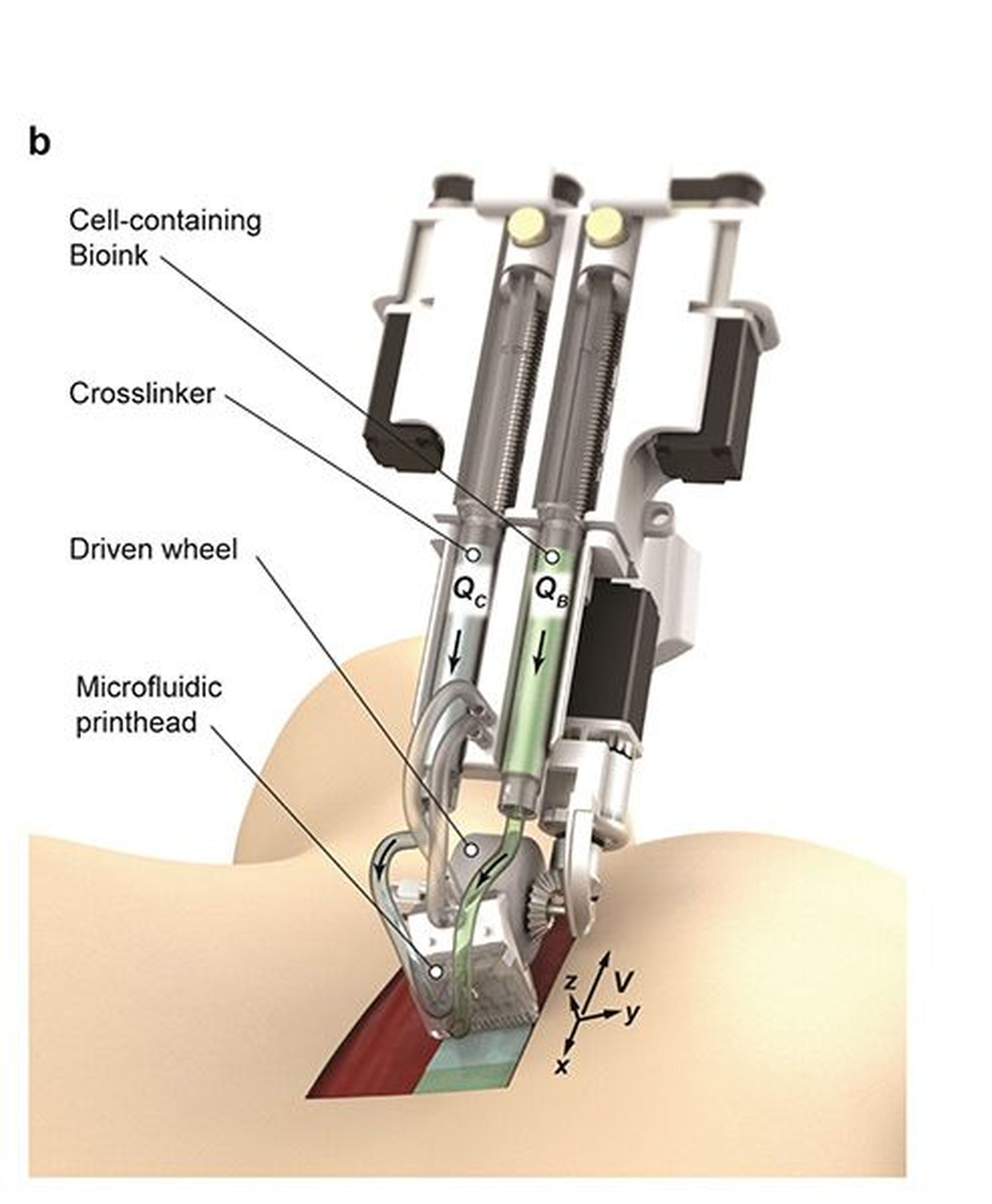 Imagen renderizada de la impresora de mano que deposita biotinta directamente sobre la herida.