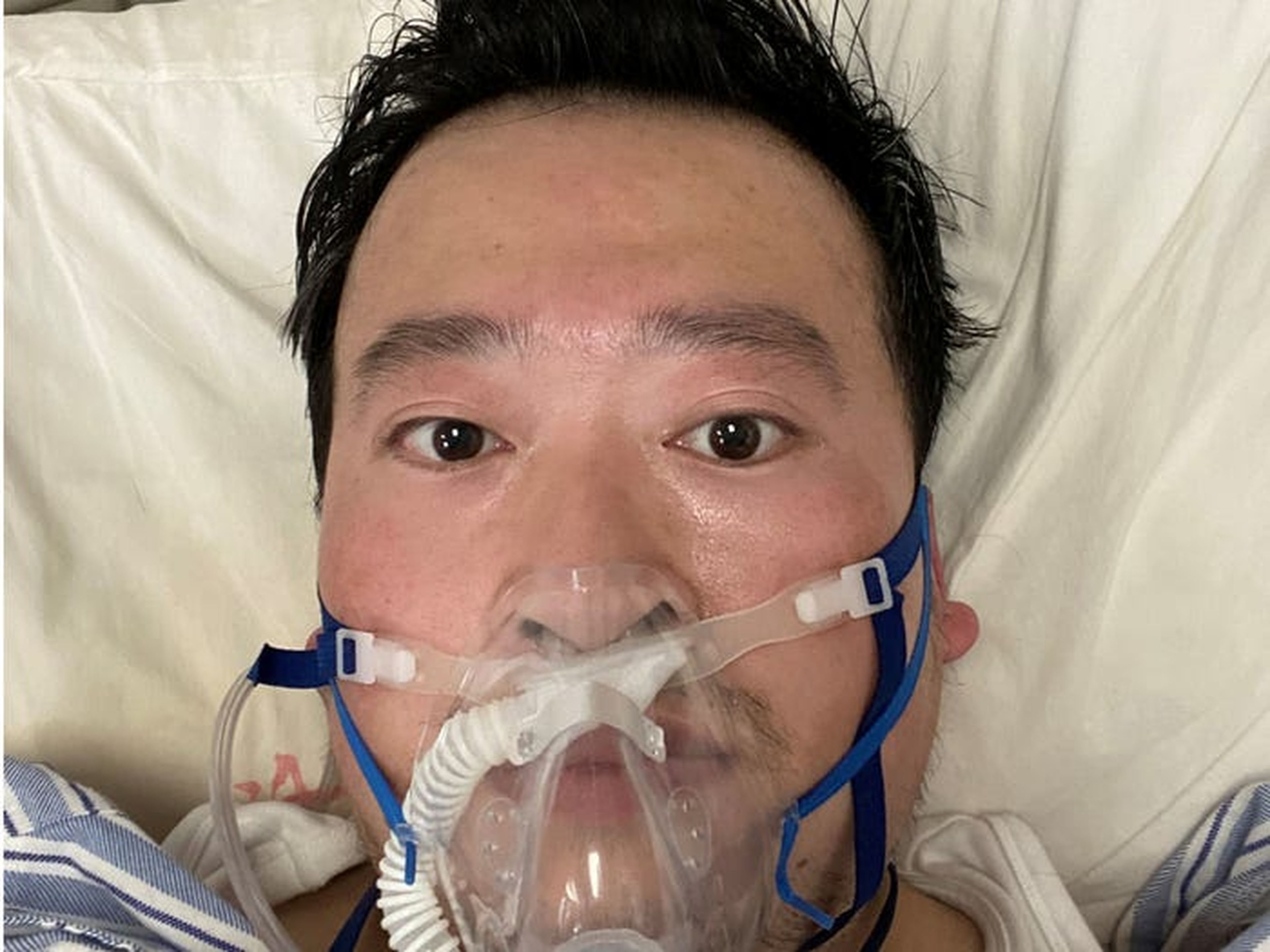 Li Wenliang con una máscara para respirar, tras enfermar por el brote de coronavirus, en Wuhan, China, el 3 de febrero de 2020.