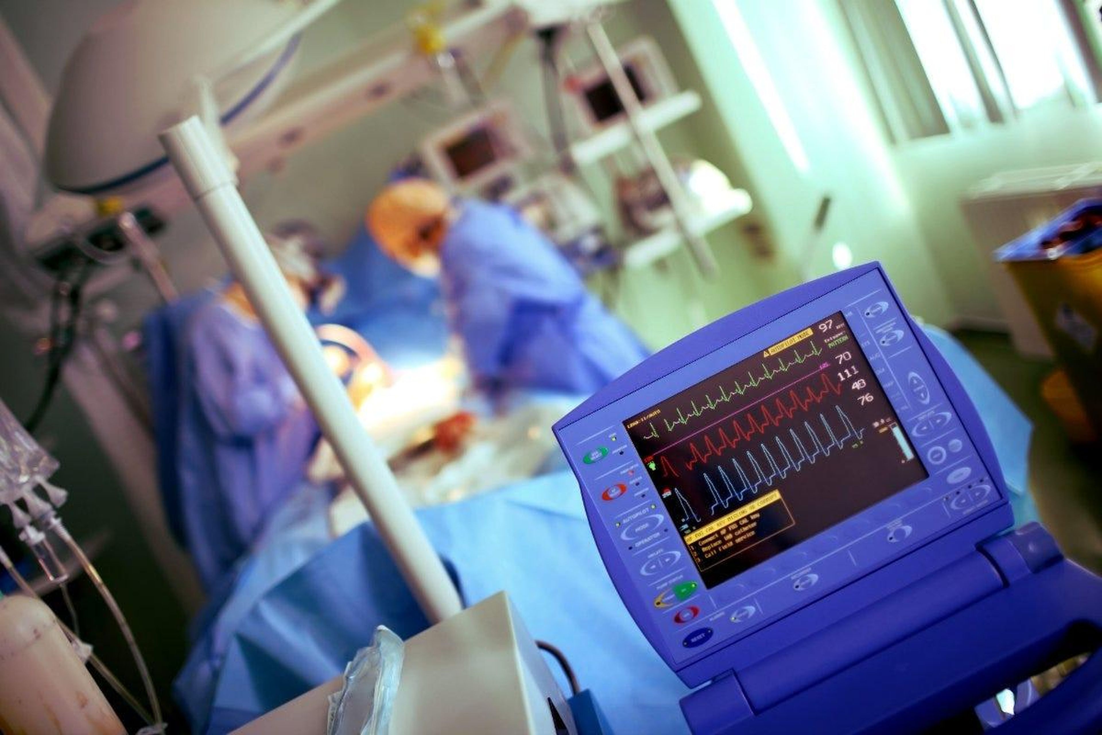 Un monitor que muestra la actividad cardíaca de un paciente durante un procedimiento médico.