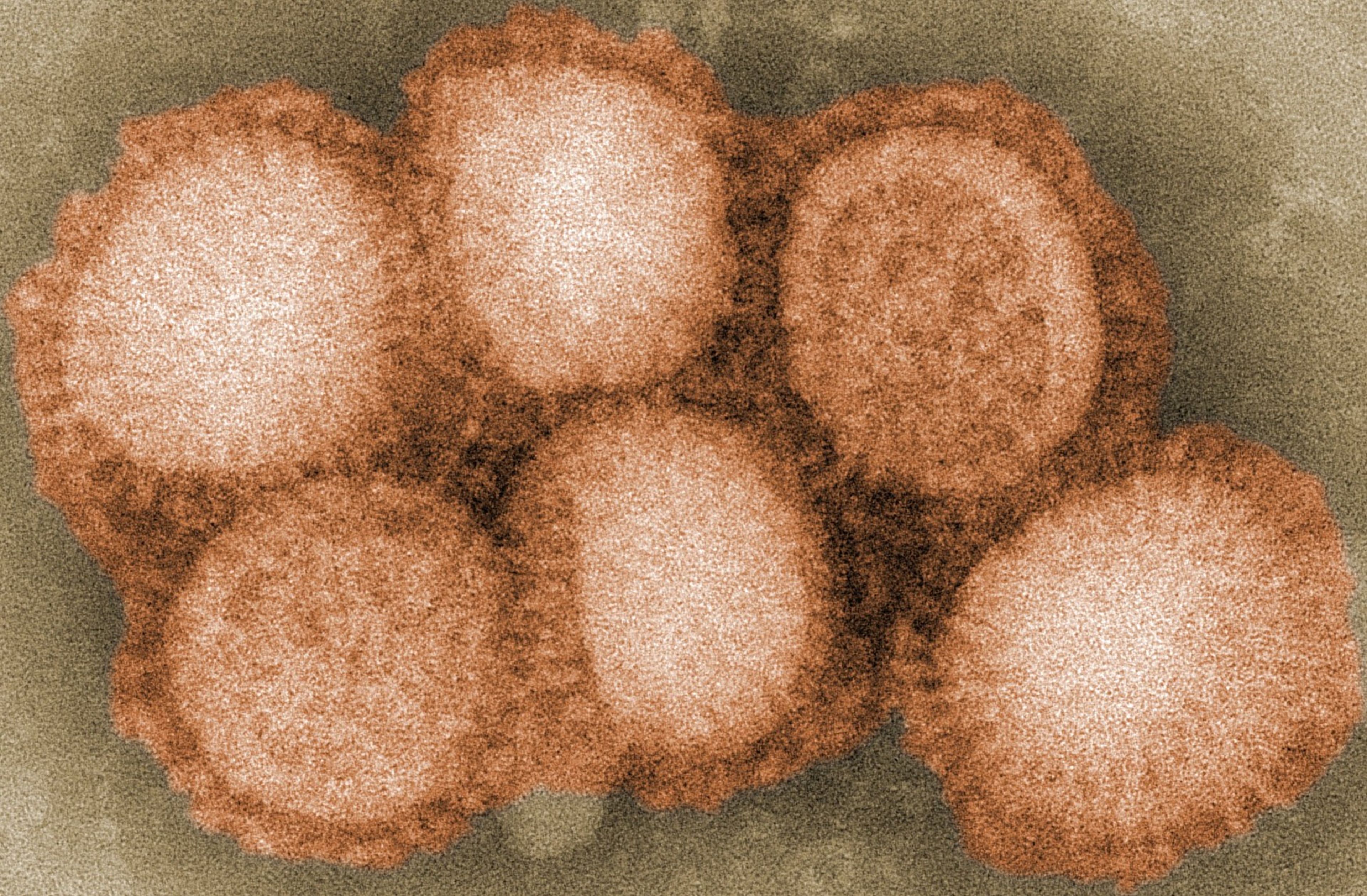 Serotipo del virus de la gripe.