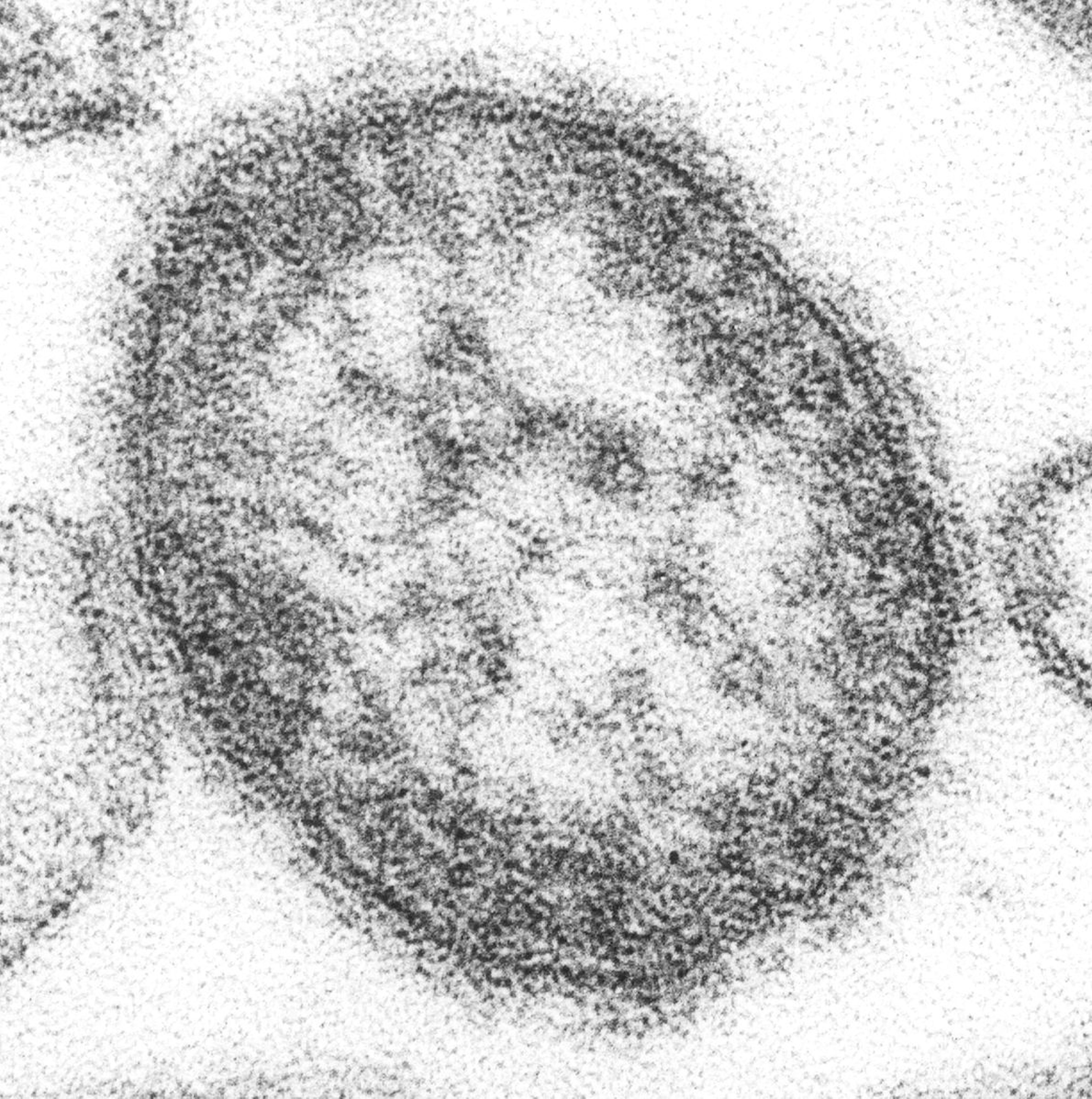 Virus del sarampión.