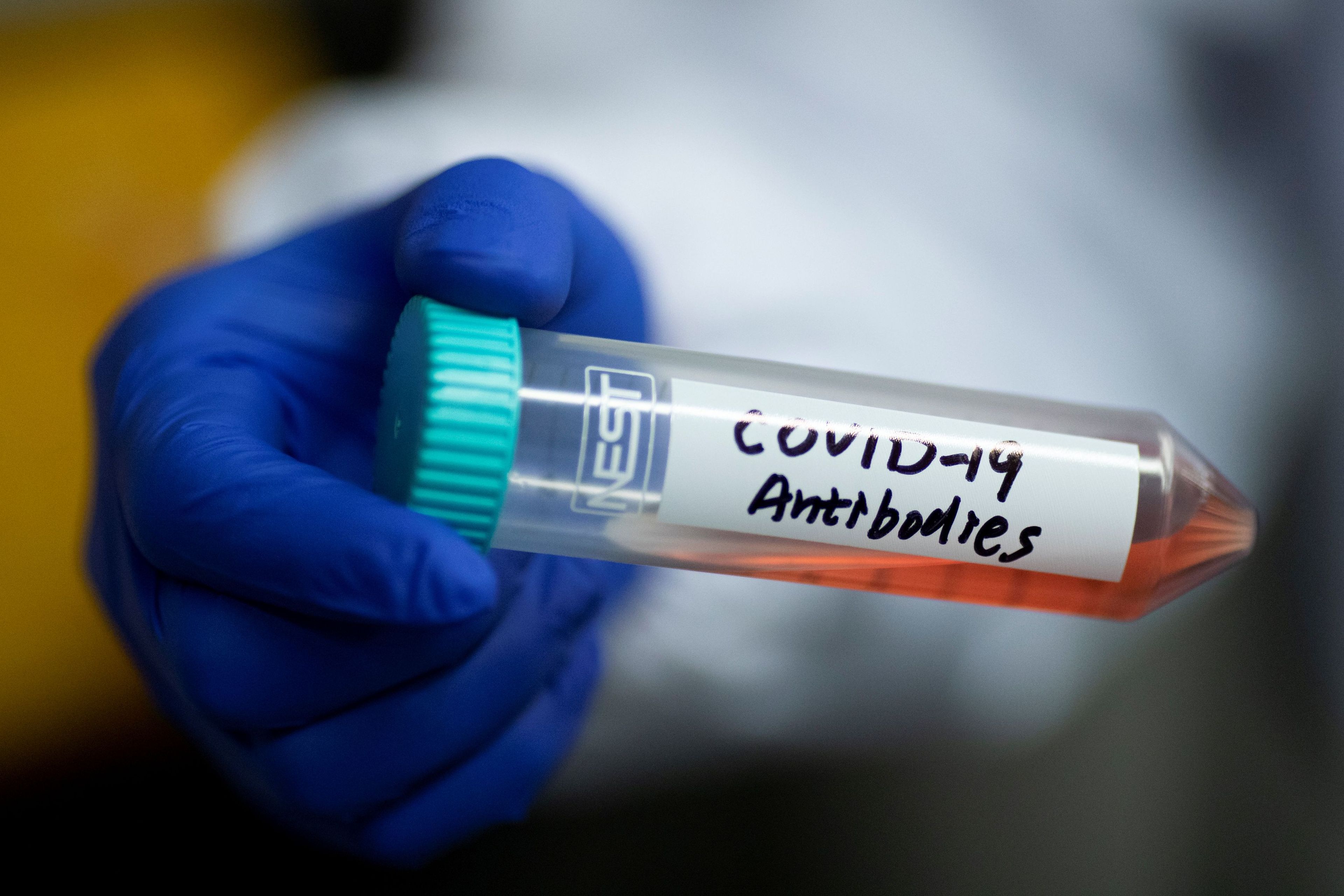 Los anticuerpos presentes en la sangre de los infectados con coronavirus también se está utilizando para tratar a algunos enfermos.
