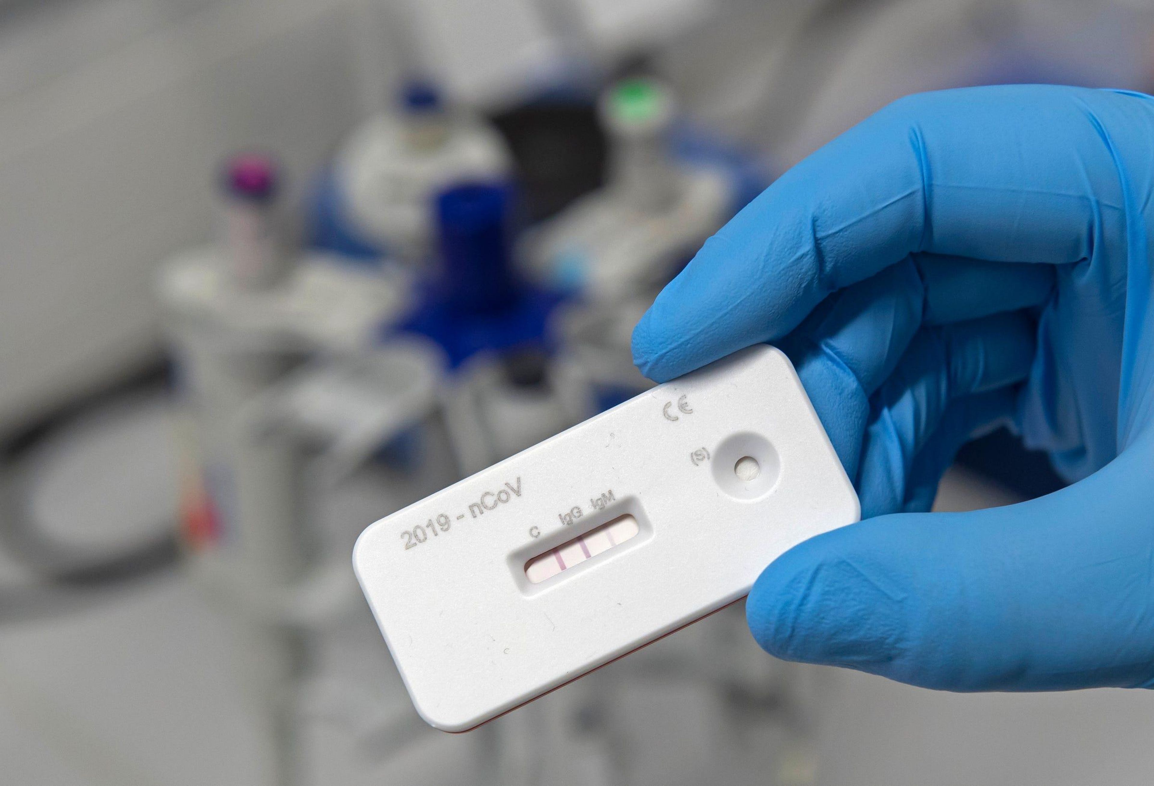Un científico presenta una prueba de anticuerpos para el coronavirus en un laboratorio del Instituto Leibniz de Tecnología Fotónica (Leibniz IPHT) en Jena, Alemania, el 3 de abril de 2020.
