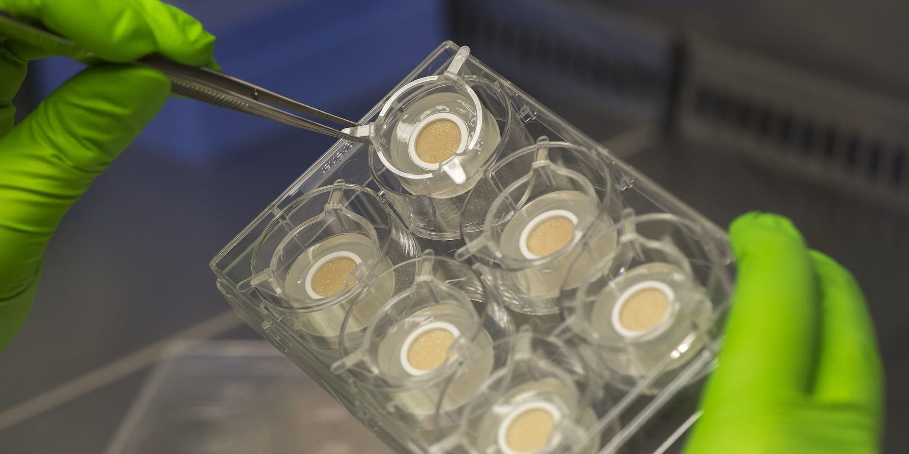 Una serie de muestras de Genoskin encapsuladas en la masa de gel patentada por la compañía.