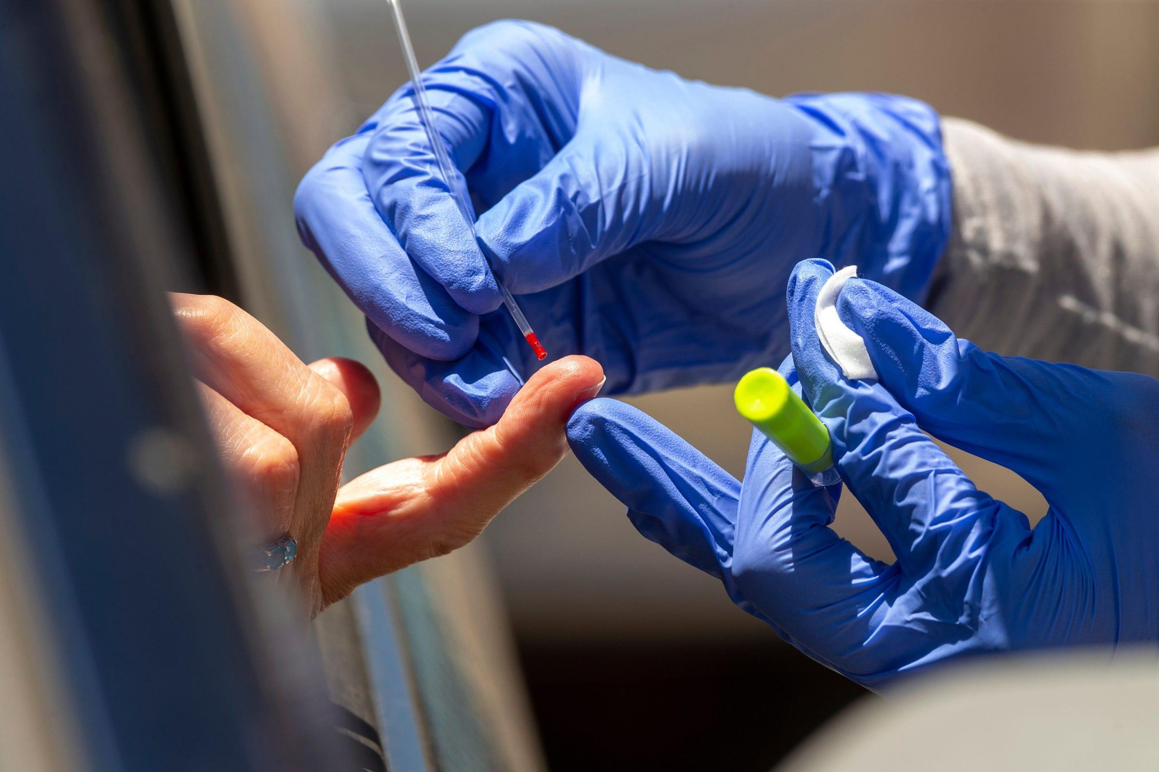 Un sanitario toma una muestra de sangre para una prueba de anticuerpos COVID-19 en Los Ángeles el 20 de mayo.