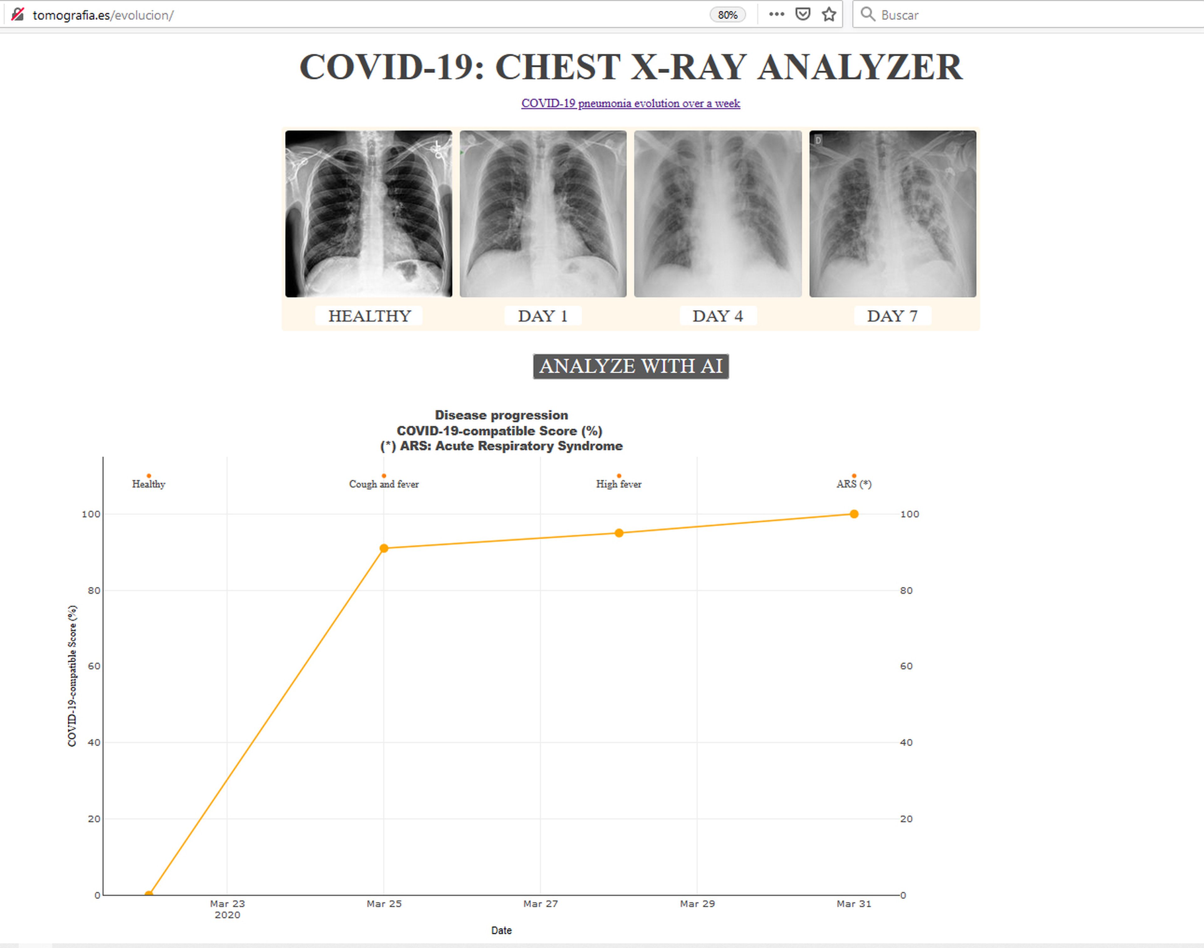 Imágenes del análisis de la evolución de varias radiografías con la herramienta de la web de X-COV.