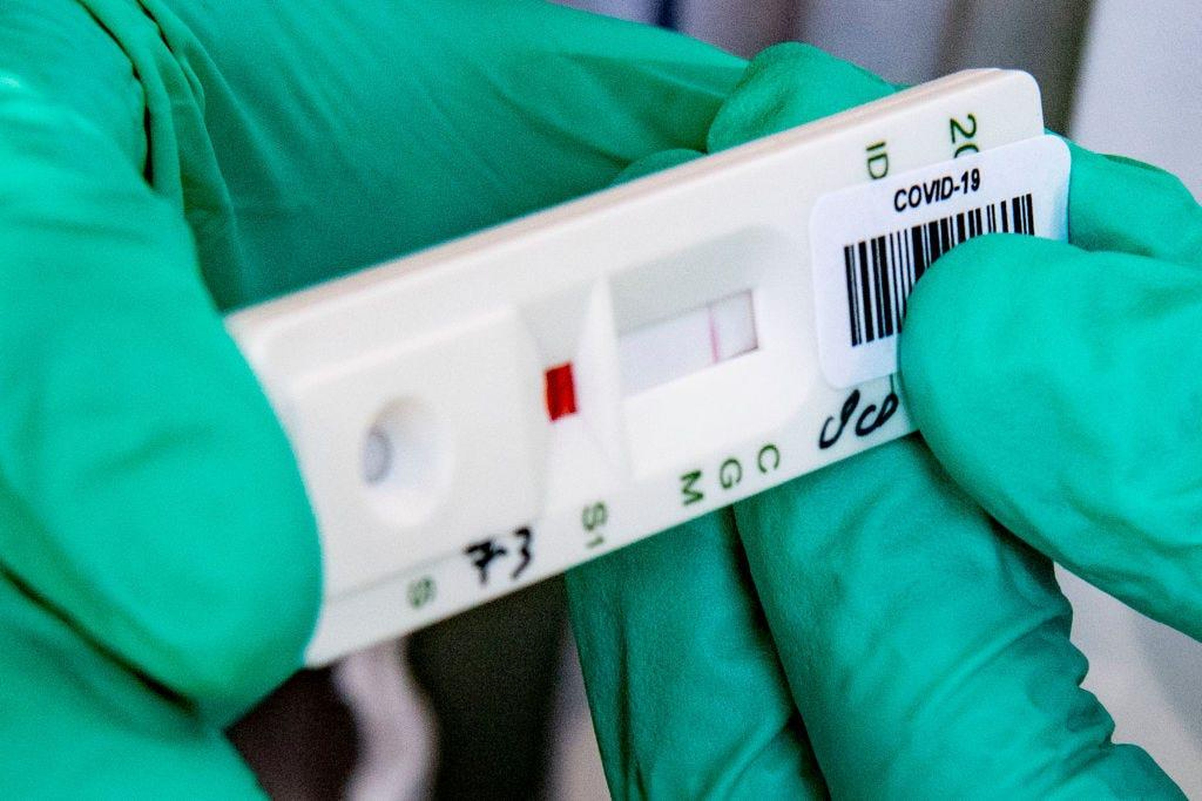 Resultados de una prueba de anticuerpos contra coronavirus usando una muestra de sangre.
