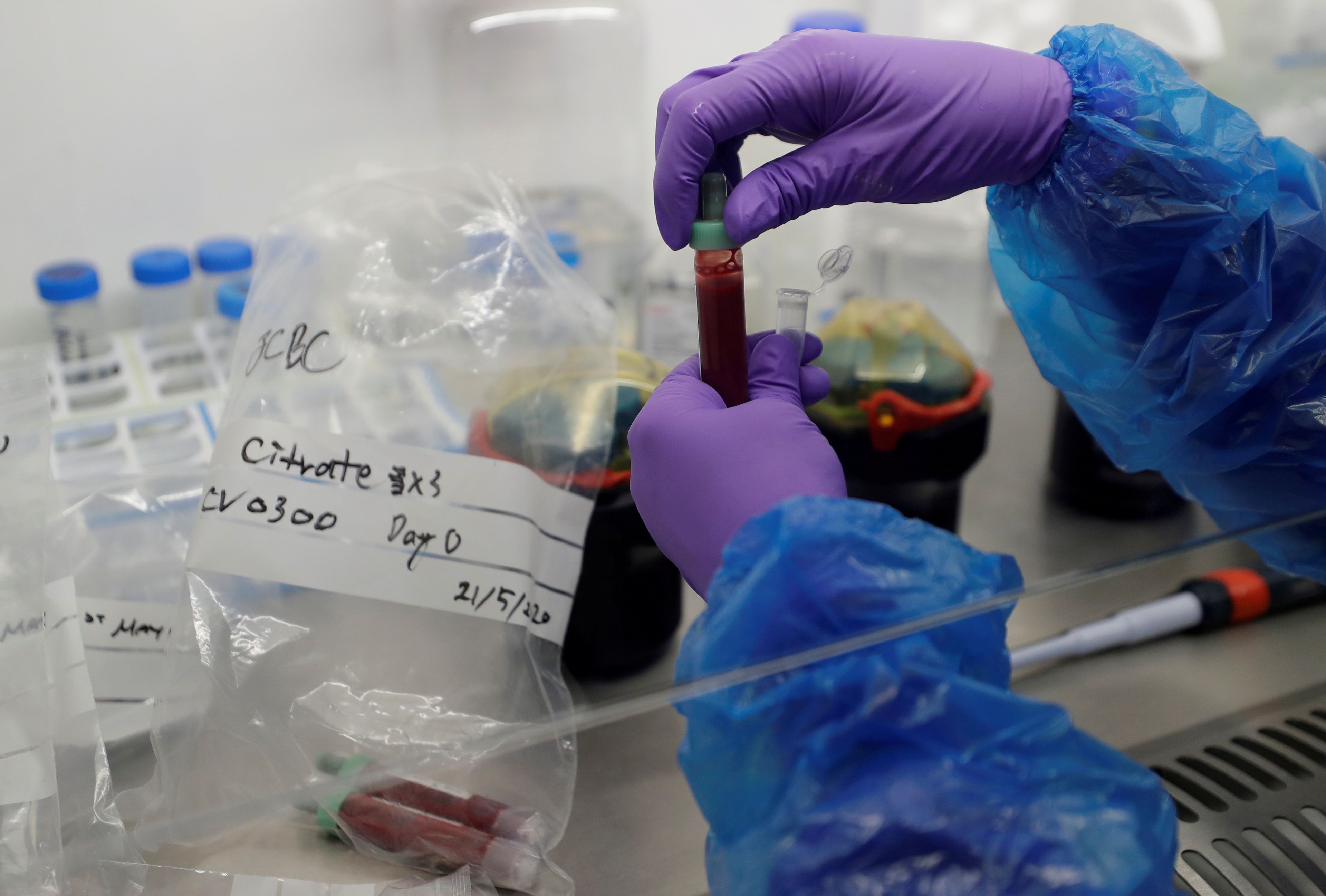 Laboratorio de procesamiento de sangre en el Instituto de Inmunología Terapéutica y Enfermedades Infecciosas de Cambridge.
