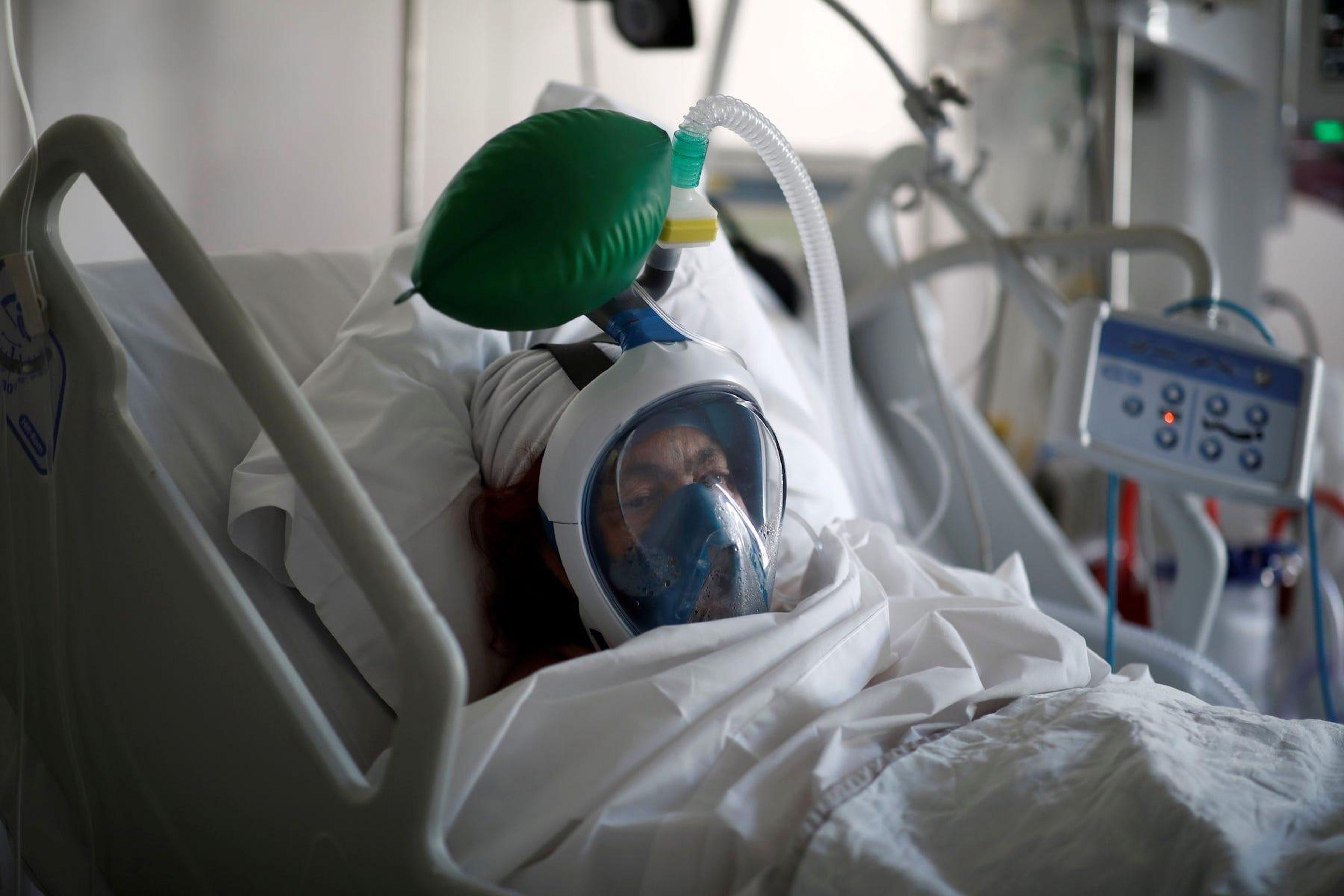 Un paciente con coronavirus lleva una máscara de buceo convertida en un ventilador en París, 1 de abril de 2020.