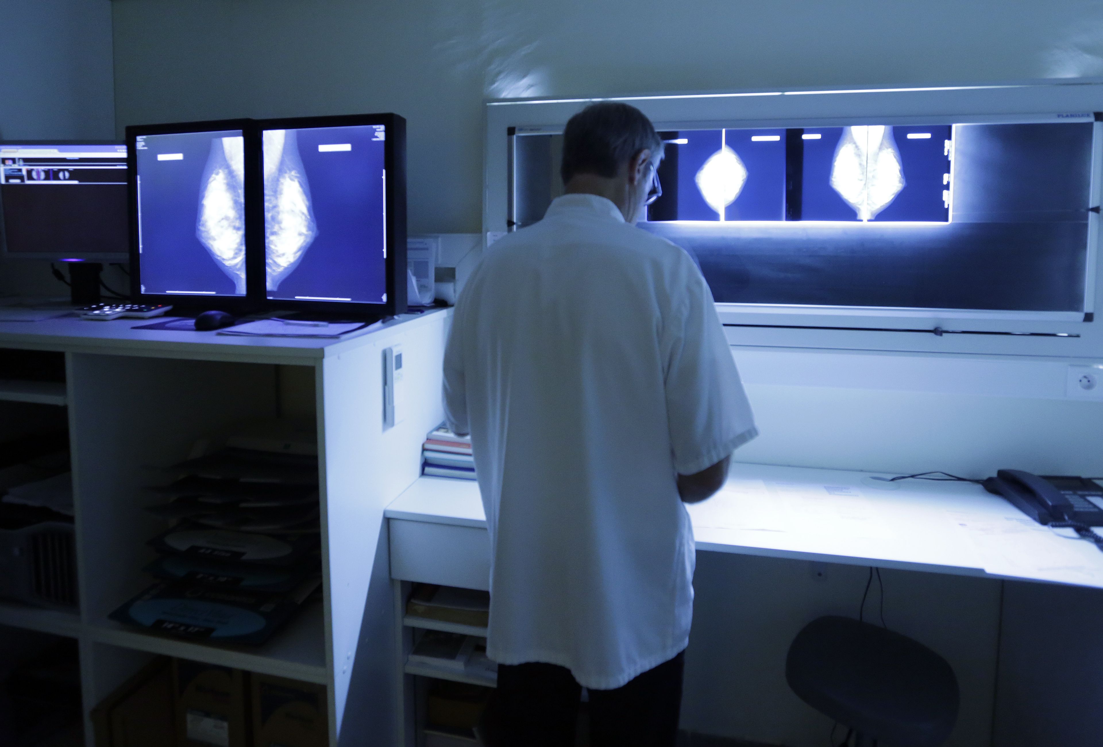 Un radiólogo examina una mamografía