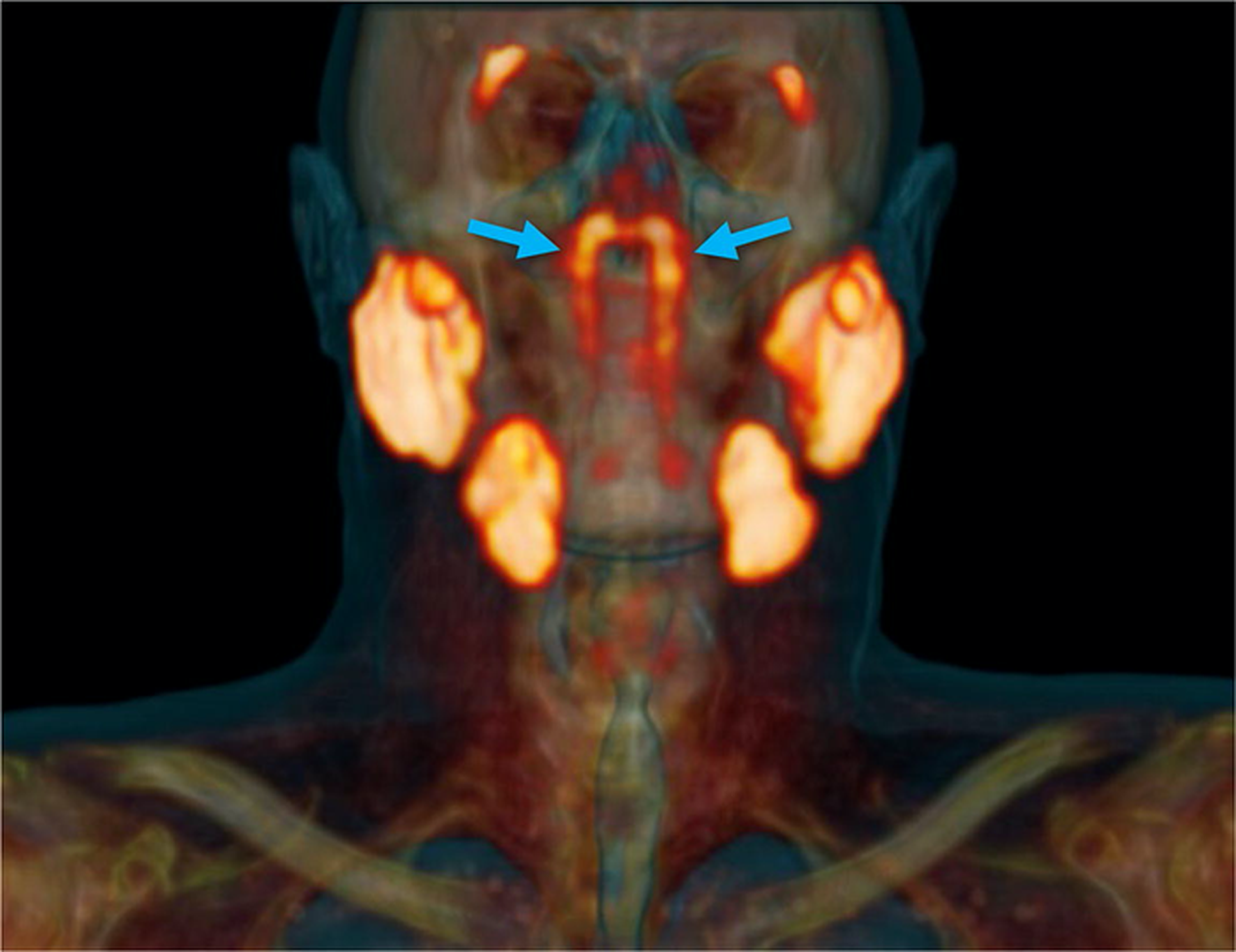 La estructura de las glándulas tubáricas, indicada por flechas azules, junto a otras glándulas salivales principales en naranja.
