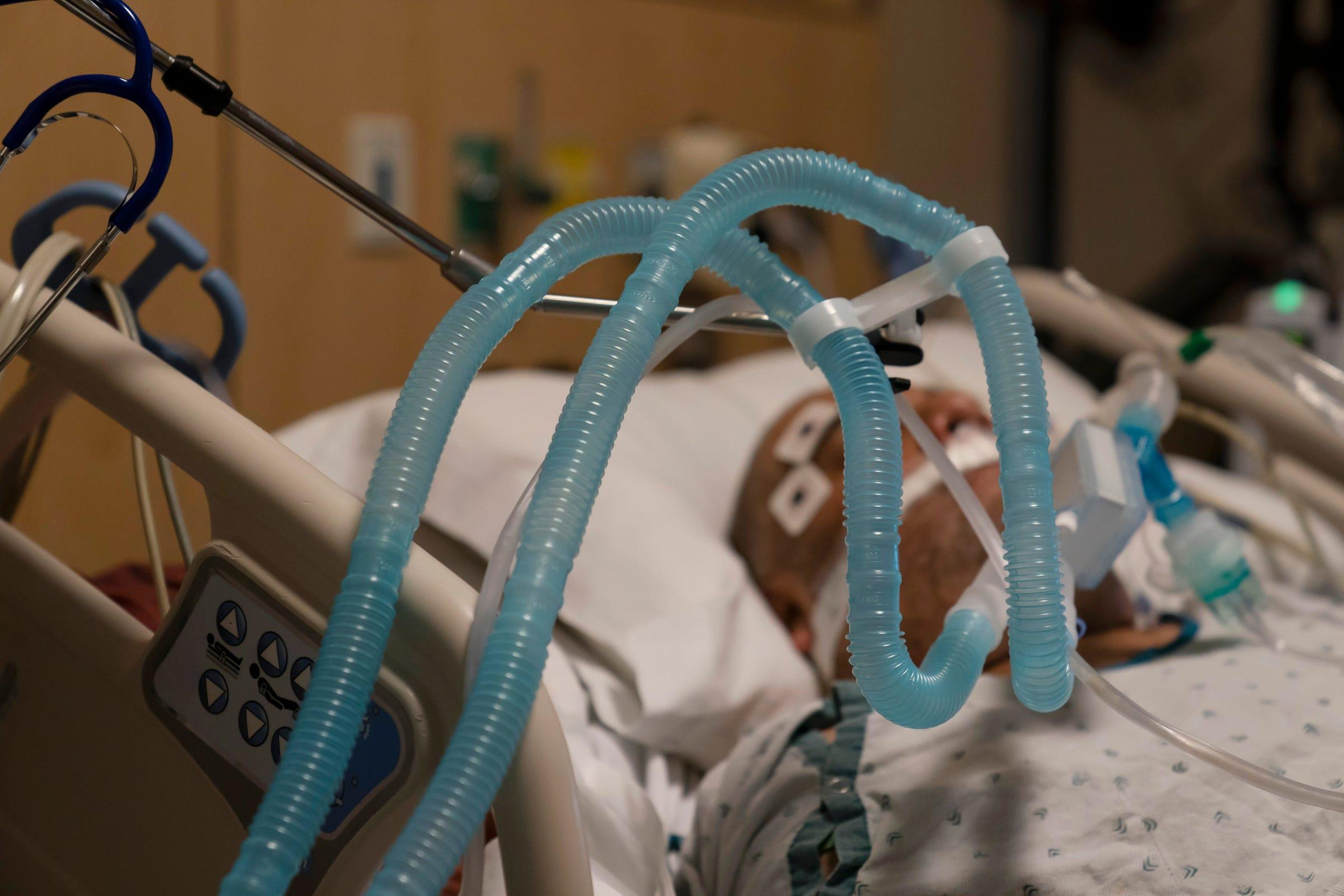 Tubos de ventilación conectados a un paciente con COVID-19 en el Providence Holy Cross Medical Center en la sección de Mission Hills de Los Ángeles el 19 de noviembre de 2020.