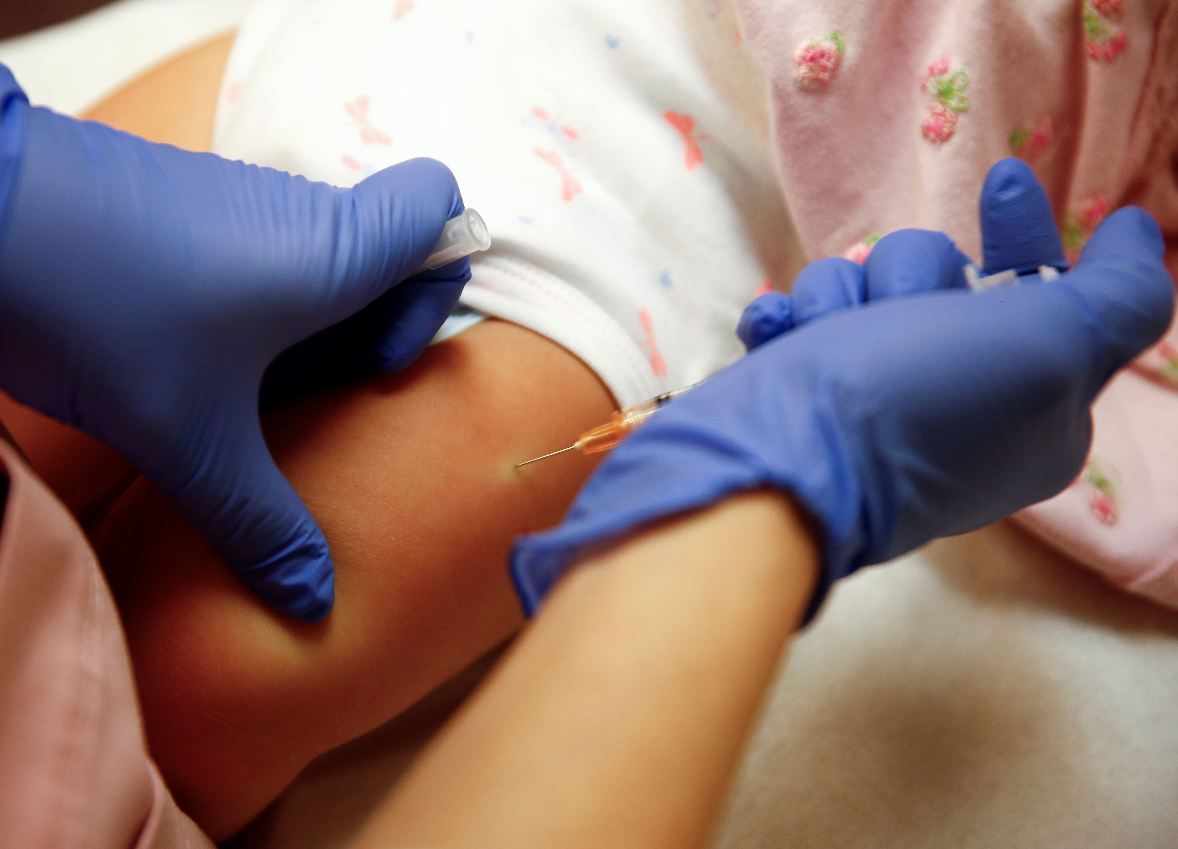 Vacuna contra la varicela a un bebé.