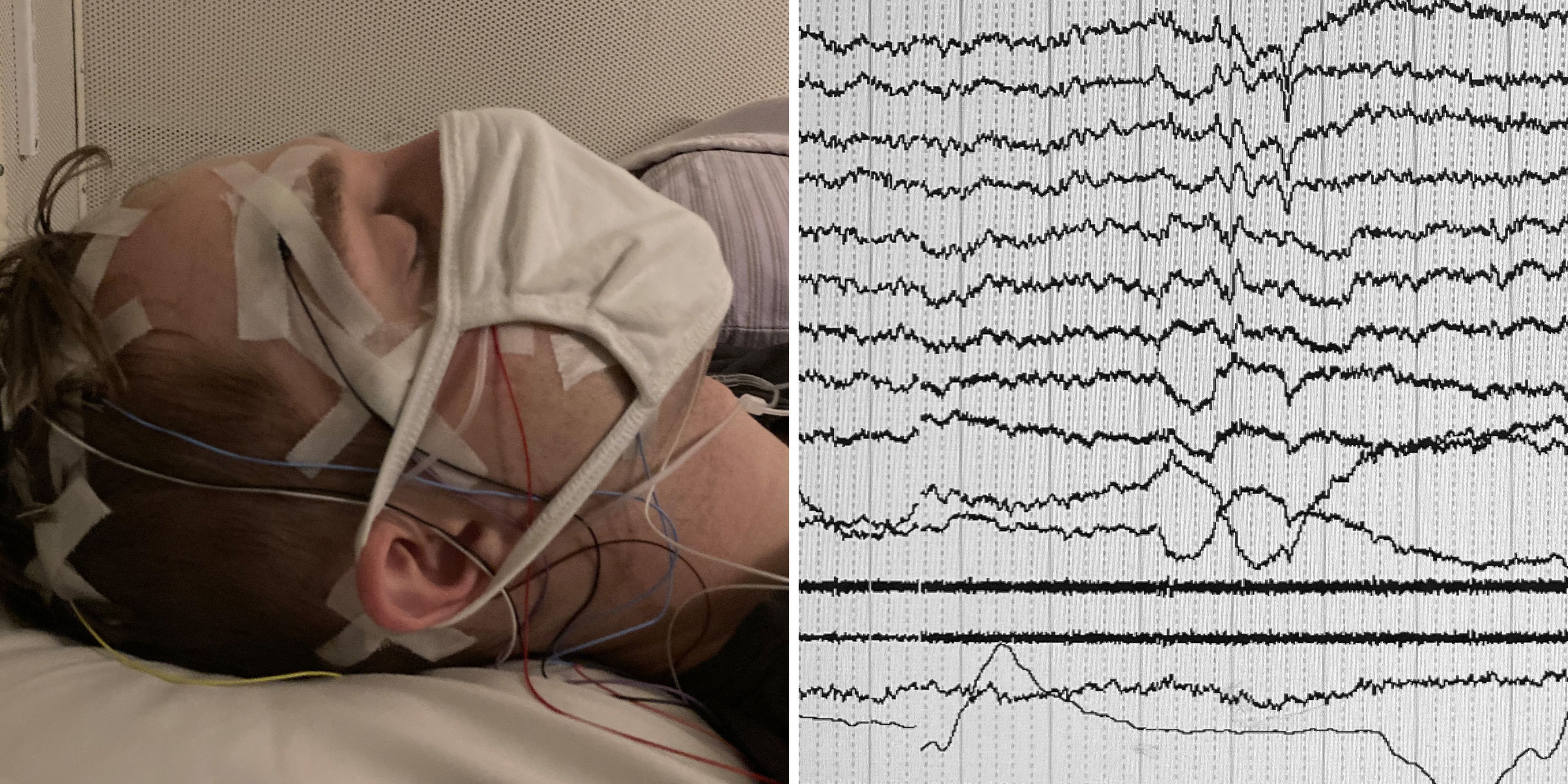 Imagen de uno de los pacientes (izquierda) y lo que quería comunicar (derecha).