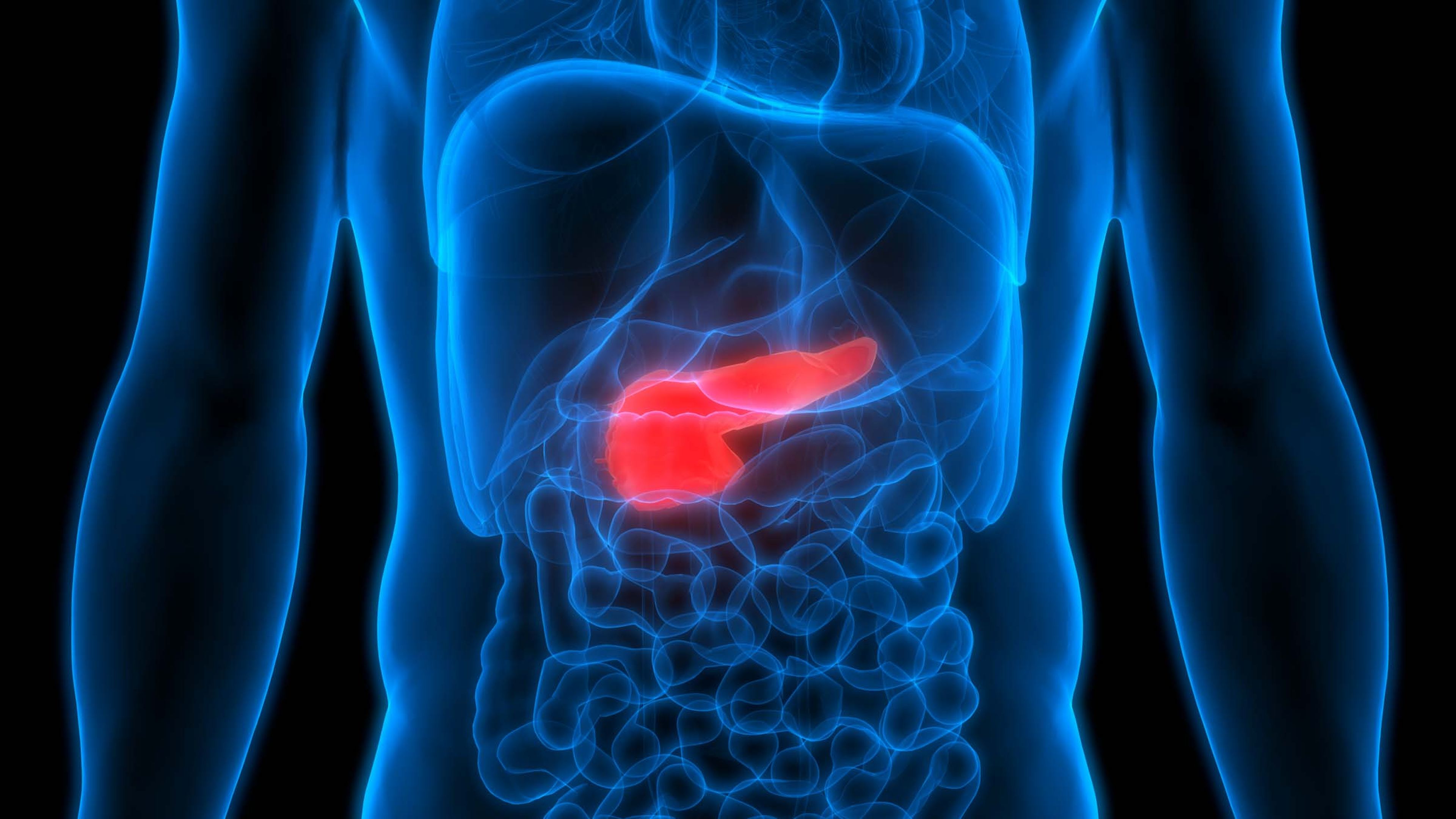 ¿Qué es el cáncer de páncreas? Síntomas que avisan de que podrías padecerlo