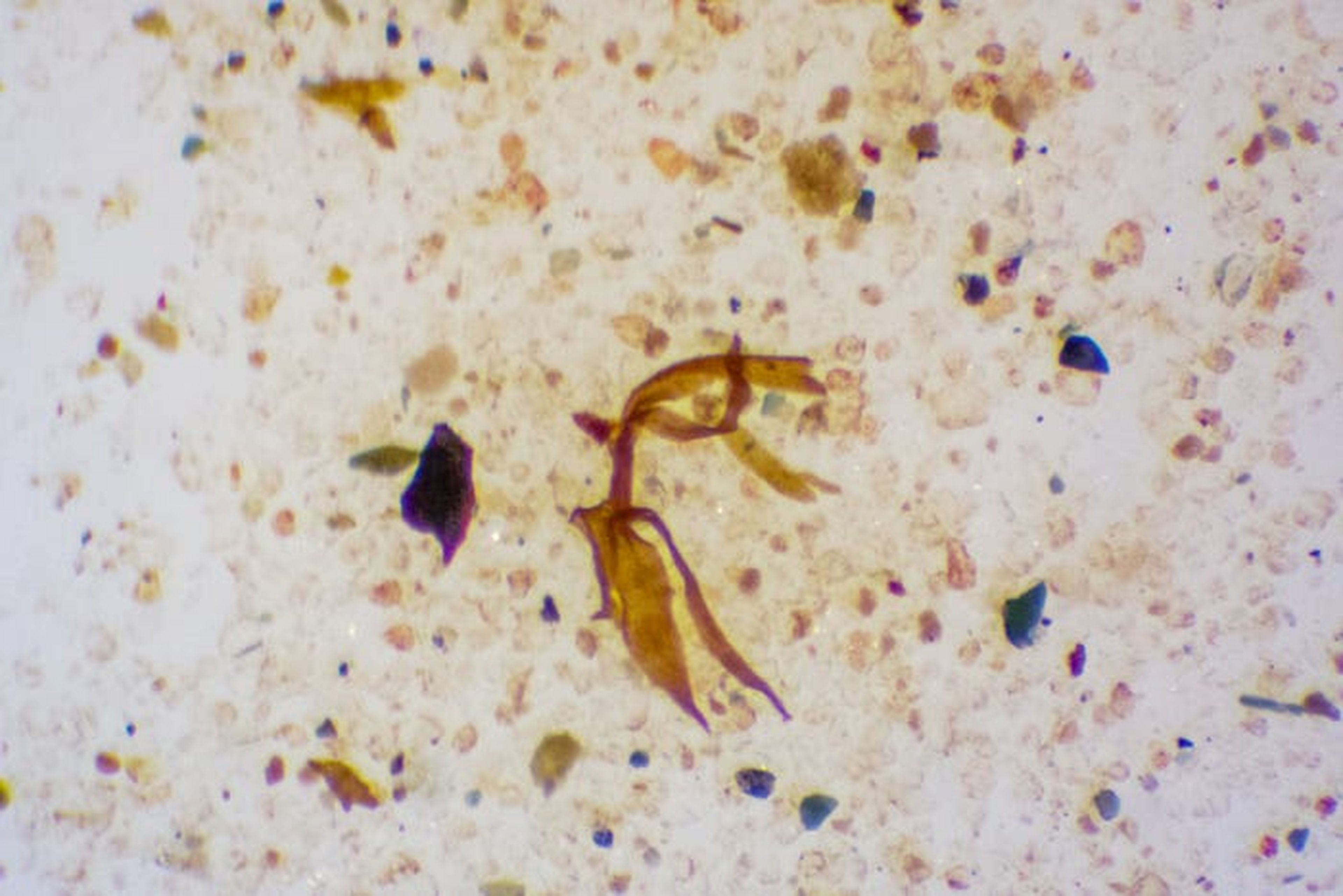Imagen tomada con microscopio de las plantas prehistóricas congeladas en la Antártida