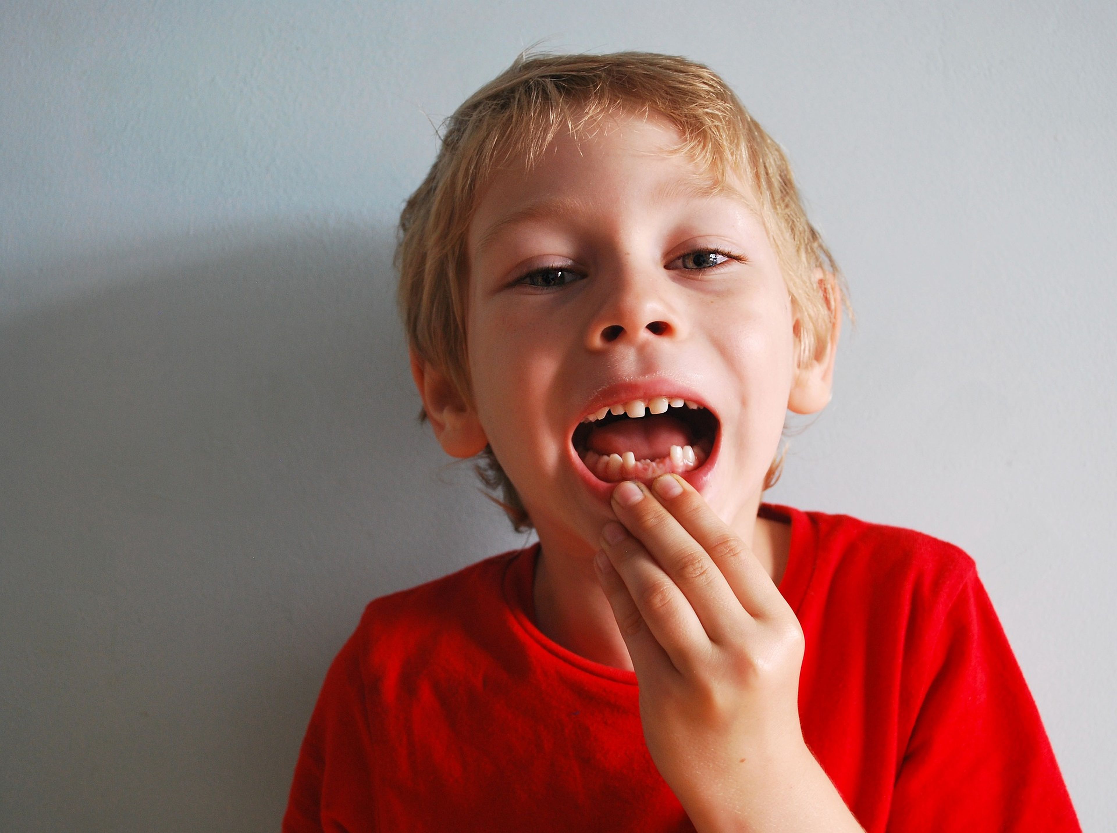 Un niño enseña la dentadura.