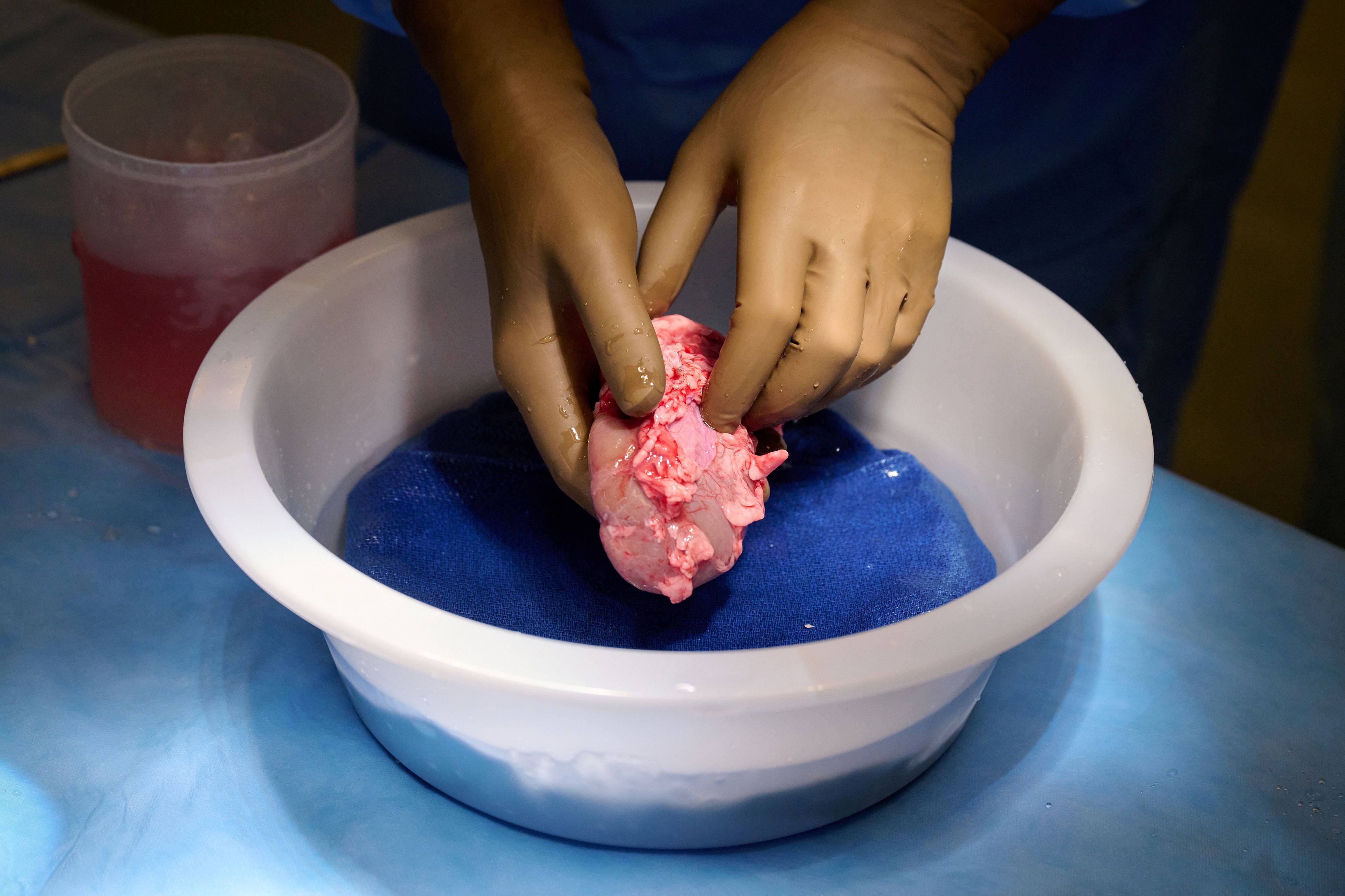 Un riñón de cerdo modificado genéticamente se limpia y se prepara para su trasplante a un ser humano en NYU Langone en Nueva York.