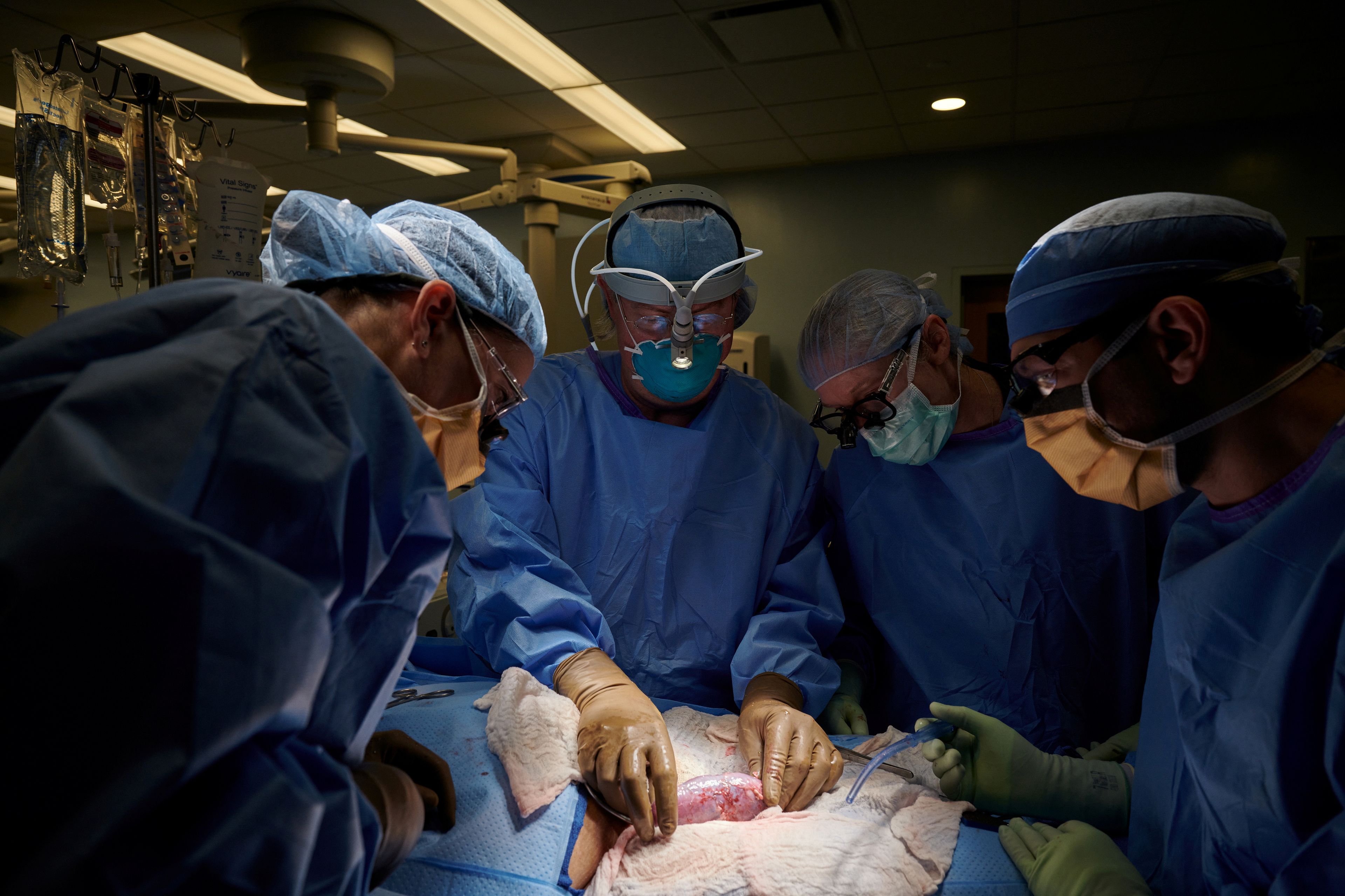 El equipo quirúrgico examina un riñón del cerdo trasplantado en busca de signos de rechazo hiperagudo.