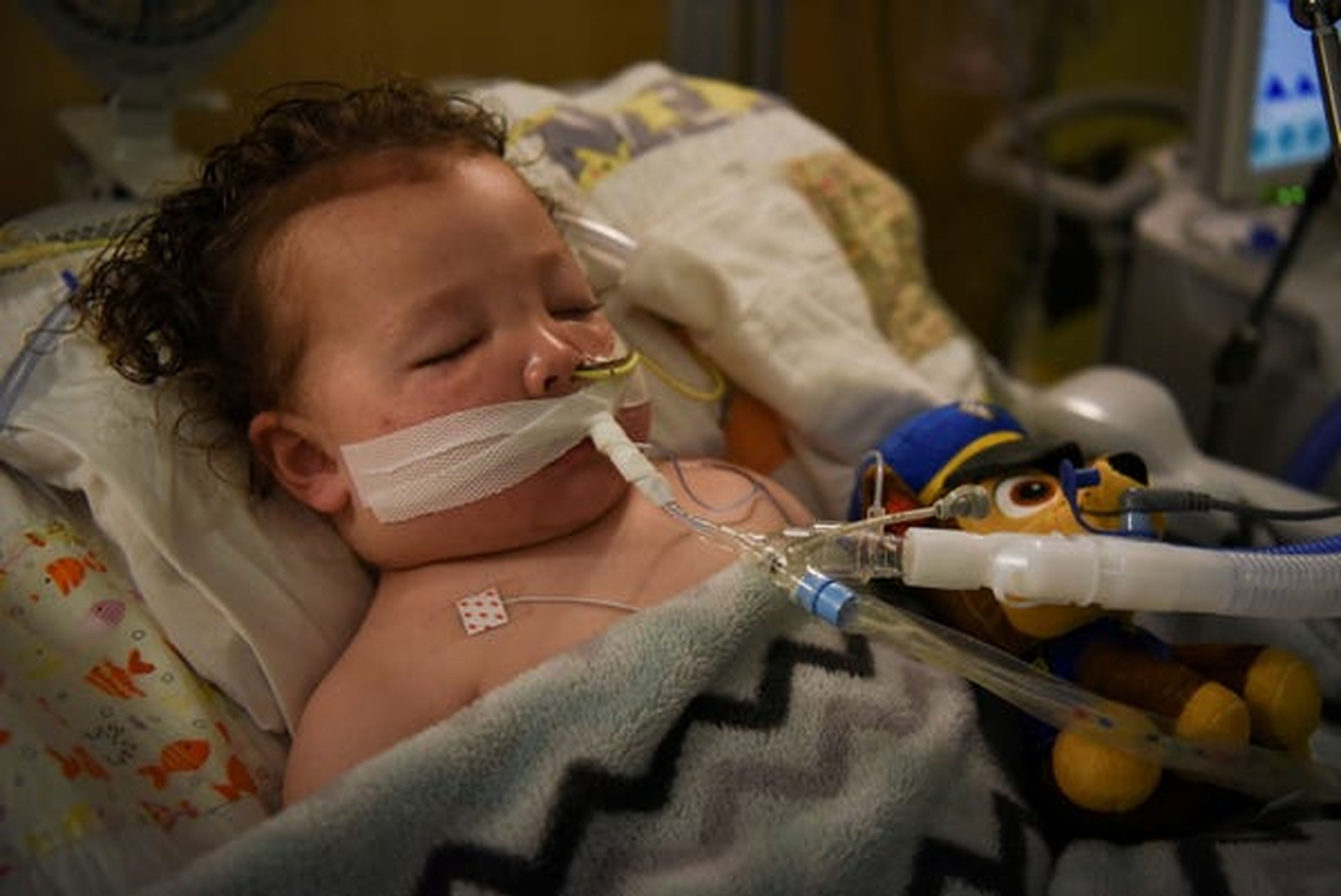 Adrian James, de 2 años, respira con la ayuda de un ventilador en el Hospital de Niños SSM Health Cardinal Glennon en St. Louis, Missouri, el 5 de octubre.