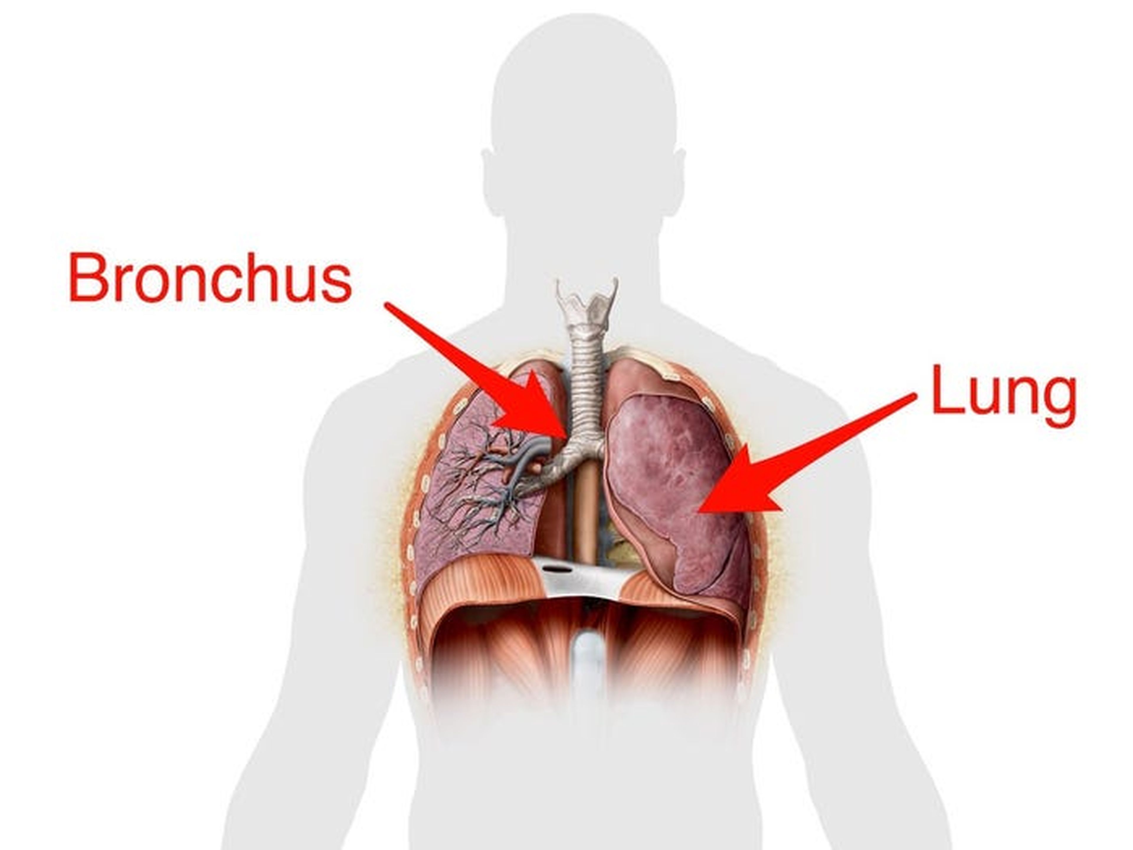 Esquema de la ubicación de los bronquios ("bronchus") y el pulmón ("lung") en el cuerpo humano.