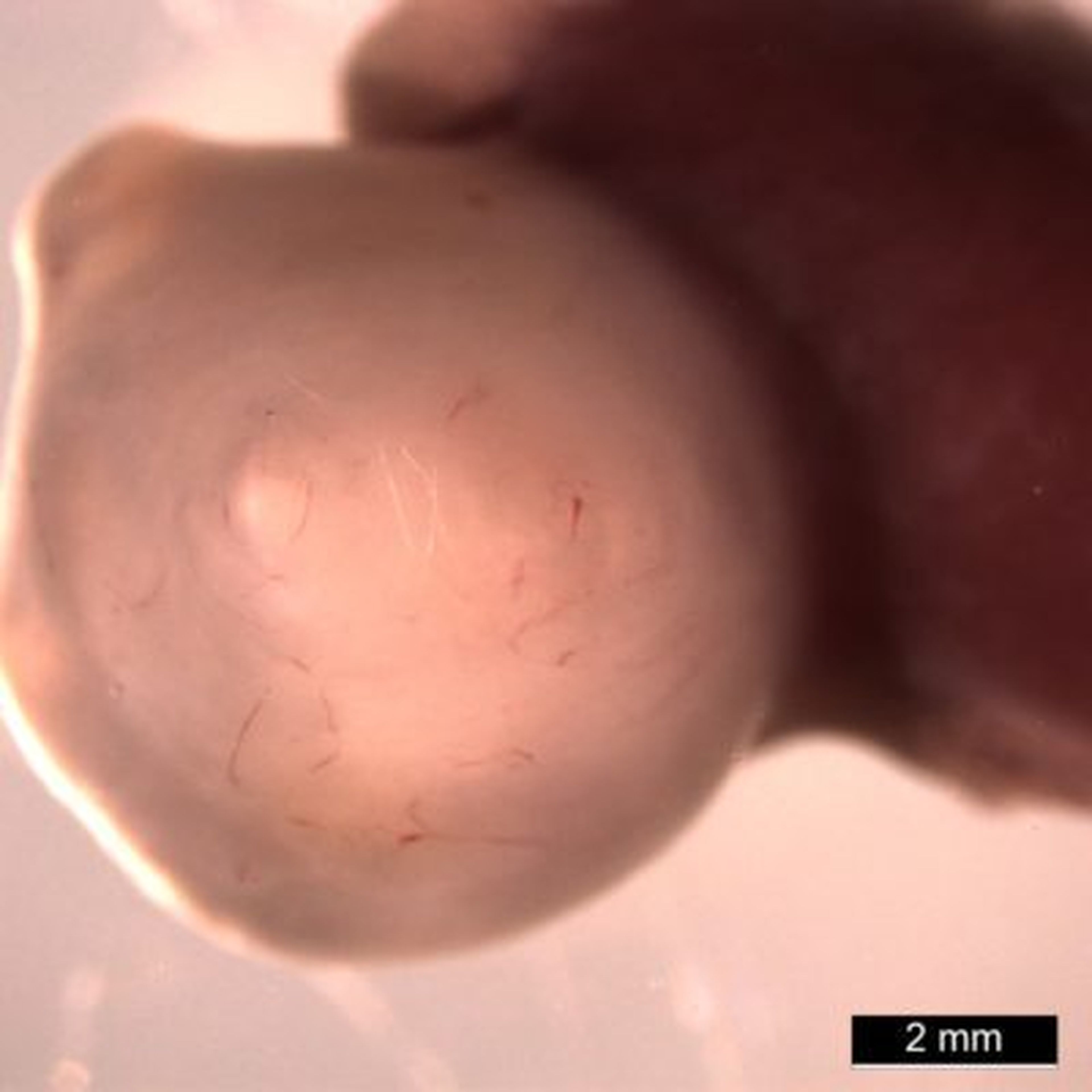 Un organoide de estómago de 10 semanas que crece dentro de un ratón.