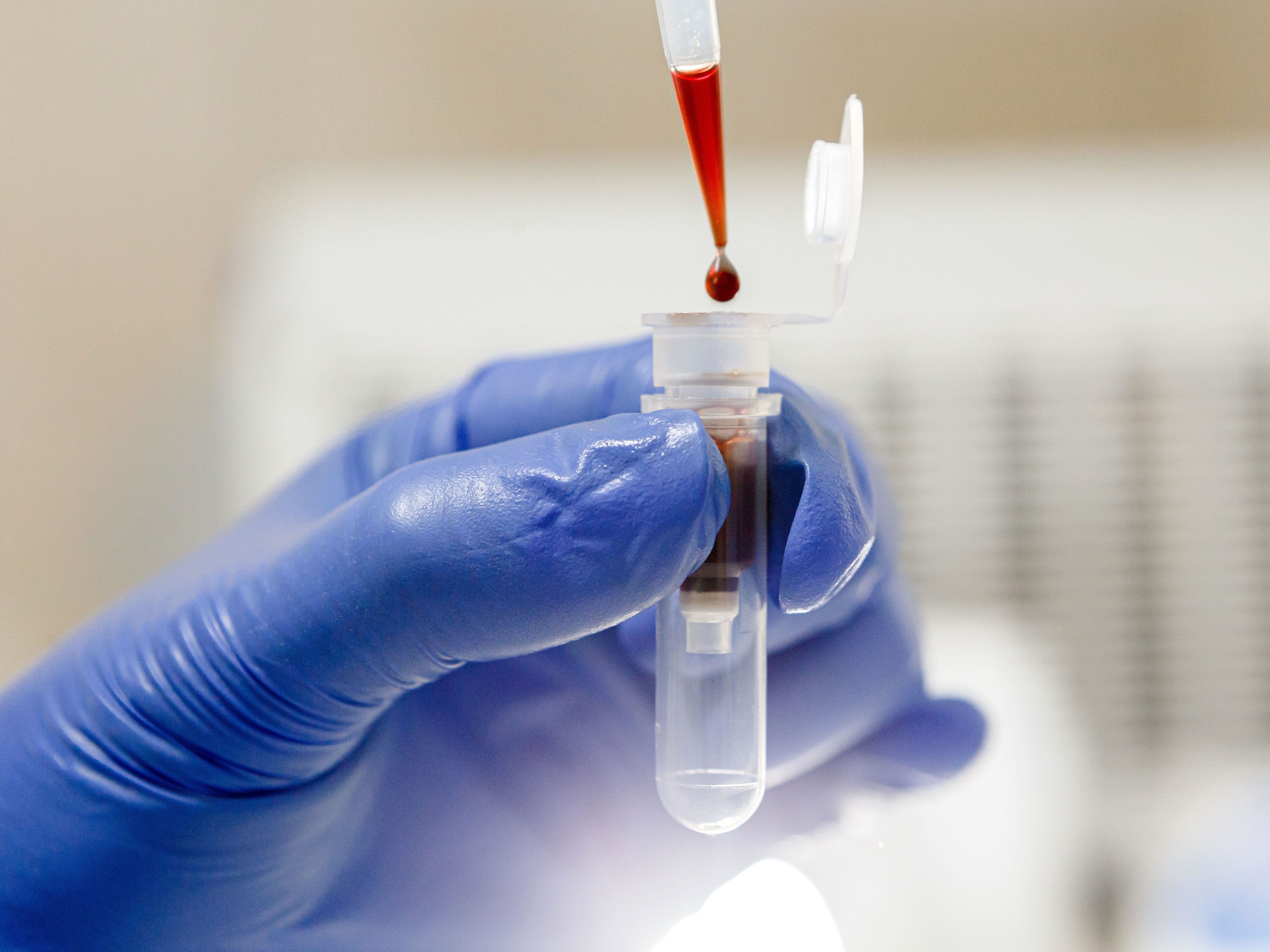 Un científico gotea sangre en un tubo de ensayo. Grail, que está siendo adquirida por el gigante de la secuenciación genética Illumina, planea lanzar en Estados Unidos una prueba de detección de cáncer basada en la sangre en 2021.