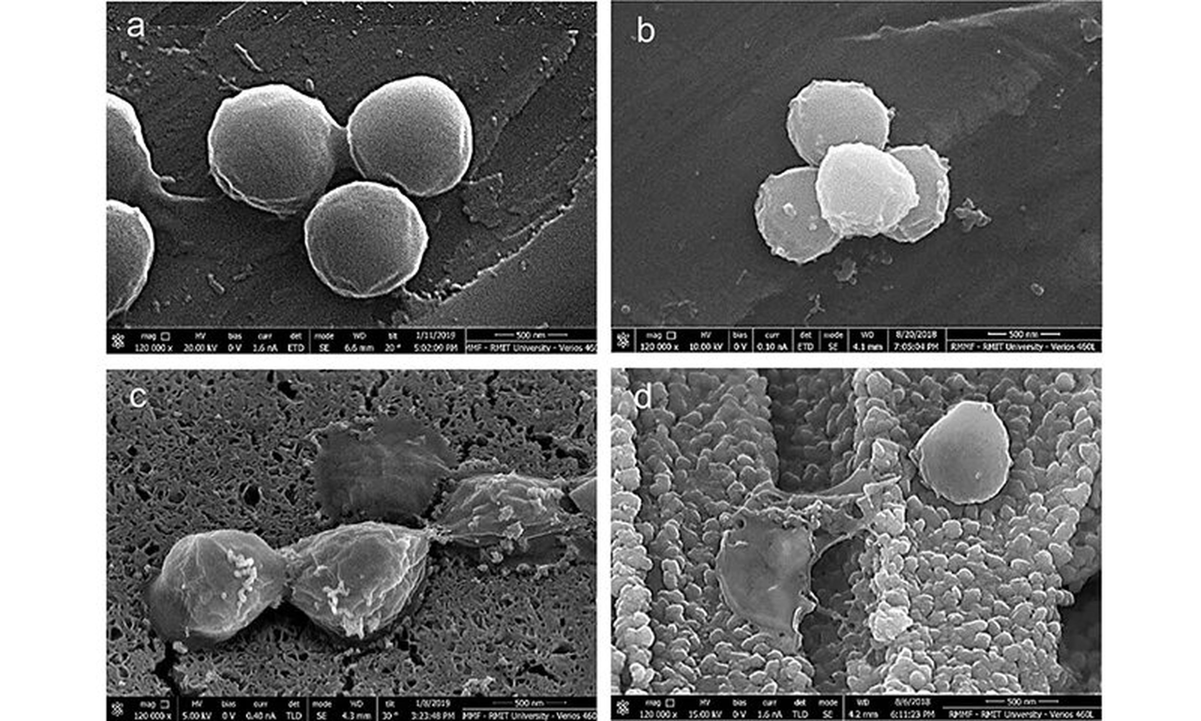 Célilas de la bacteria del estafilococo dorado en diferentes superficies.