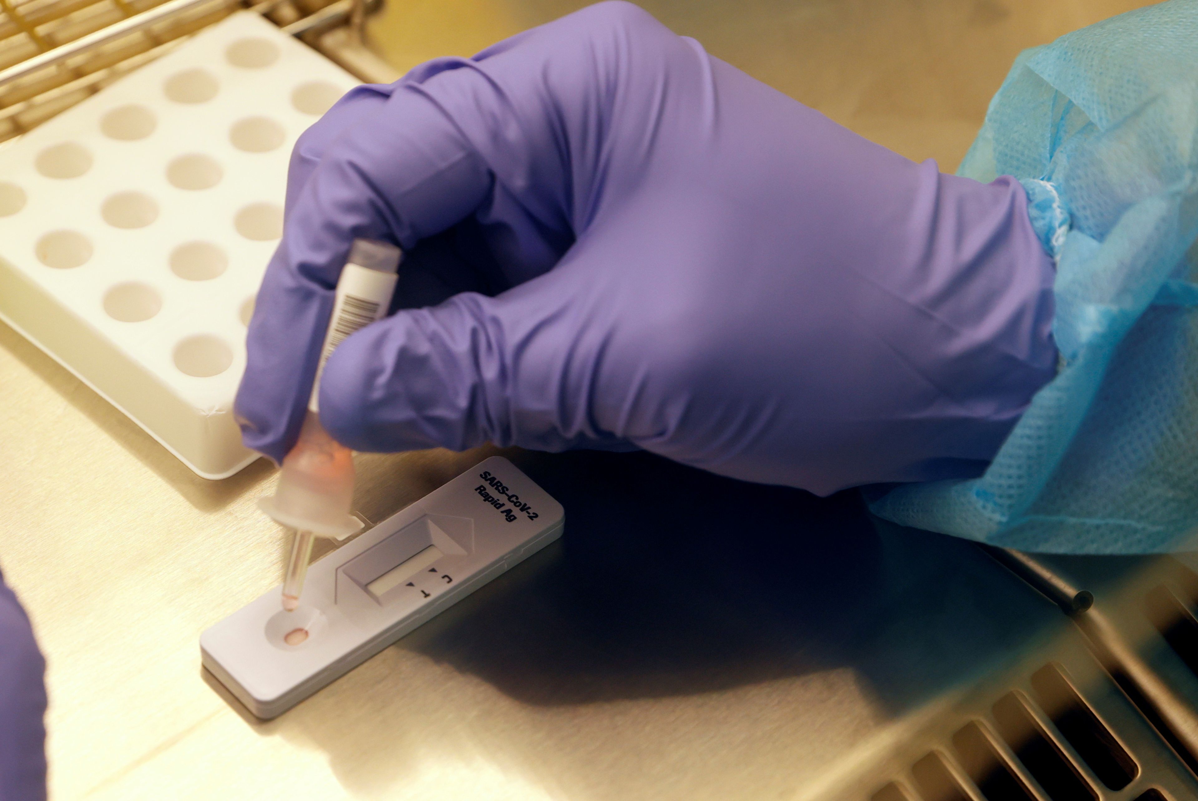 Test de antígenos covid siendo procesado