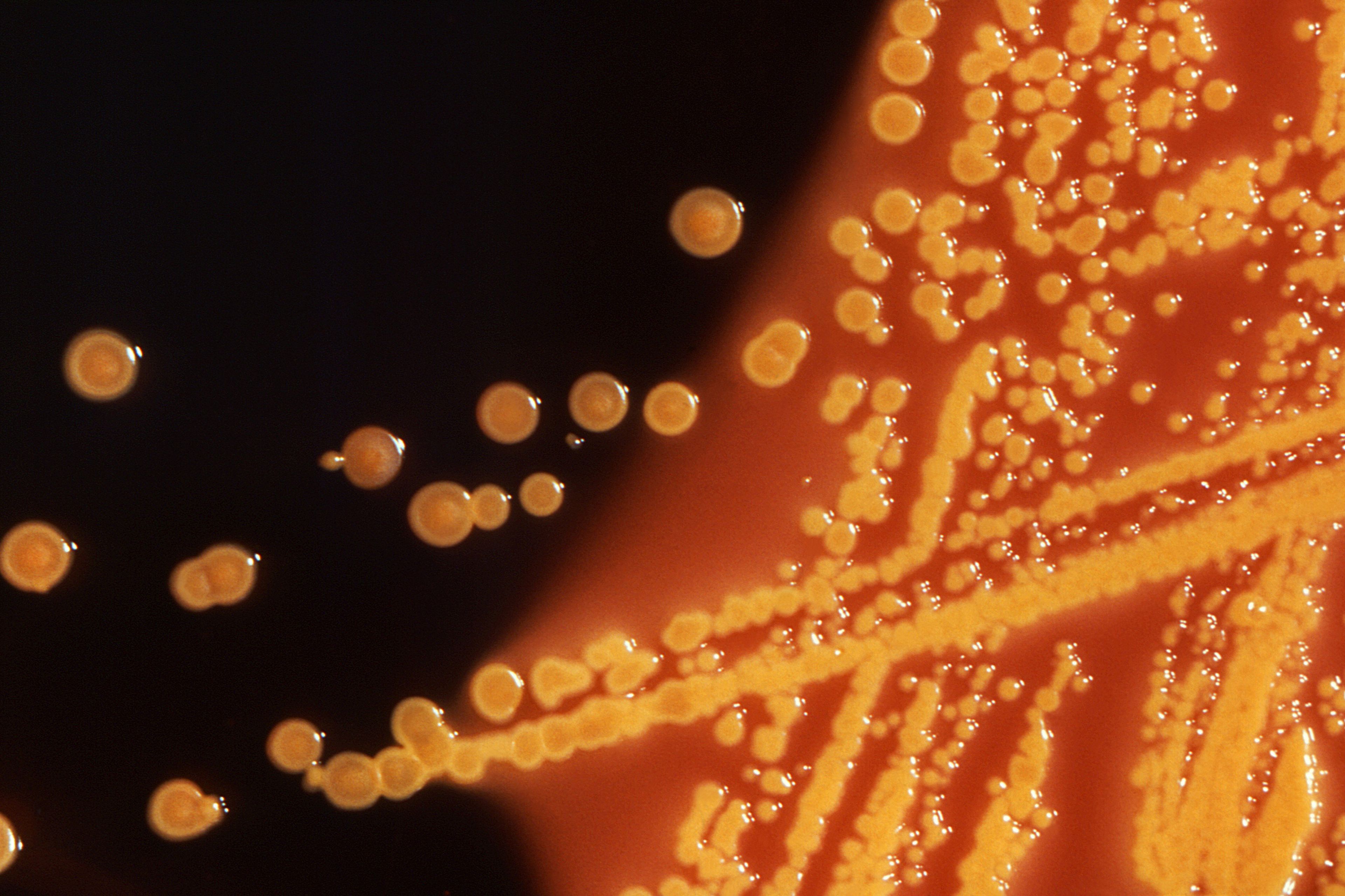 'E. coli' vista al microscopio.